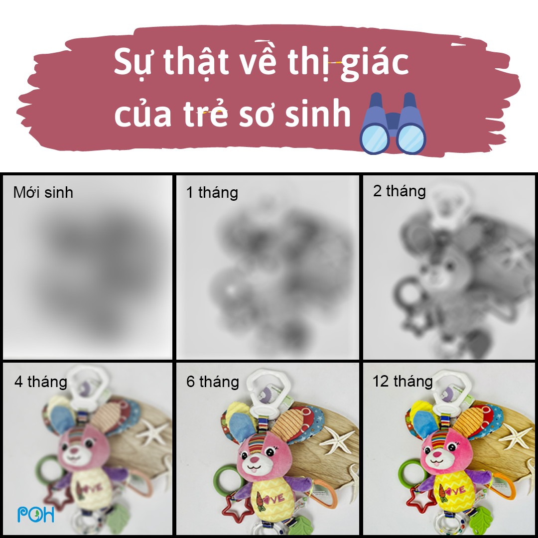 SỰ THẬT VỀ THỊ GIÁC CỦA TRẺ SƠ SINH

Ngay từ khi vừa chào đời, trẻ sơ sinh đã bắt đầu khám phá thế giới bằng đôi mắt của mình. Ngoài việc học khả năng tập trung mắt, di chuyển mắt nhìn chính xác, thì trẻ còn phải học cách xử lý thông tin hình ảnh mà mắt gửi đến não để hiểu về thế giới xung quanh.

Ban đầu, khi mới sinh ra, em bé không thể nhìn thấy rõ tất cả mọi vật vì hệ thống thị giác của con chưa phát triển đầy đủ. Mặc dù em bé có thể nhận ra ánh sáng, hình dạng và chuyển động, nhưng mọi thứ đều trông khá mờ và nhòe.

Thông thường, bé sẽ hướng mắt về phía cửa sổ hoặc nơi phát ra ánh sáng. Trẻ cũng sẽ chớp mắt khi ánh sáng đột ngột thay đổi, đồng thời bố mẹ dễ dàng nhận ra là con đảo mắt liên tục, vì con vẫn chưa học được cách nhìn tập trung vào một vật thể.

Trong 4 tuần đầu tiên sau khi chào đời, bé chỉ có thể nhìn thấy vật ở khoảng cách 20 – 30cm. Hoặc khuôn mặt của người đang bế mình ở khoảng cách gần. Nếu bạn bế con, hãy ghé sát mặt con một chút để trẻ có thể nhìn thấy khuôn mặt và biểu cảm của bố mẹ.

👉 1 tháng tuổi

Mặc dù bây giờ trẻ vẫn chưa thể nhìn xa nhưng điều đó không quan trọng vì dù sao bé vẫn chỉ quan tâm đến khuôn mặt của bố mẹ mà thôi. Do đó trong vài tuần đầu tiên, khi ôm ấp con, bạn hãy giao tiếp với con bằng mắt và cho con thời gian được nhìn ngắm khuôn mặt của người thân.

Trong giai đoạn từ 1 đến 2 tháng tuổi, bé sẽ học cách tập trung nhìn đồ vật bằng mắt. Điều này có nghĩa là con có thể đảo mắt nhìn theo một món đồ di chuyển trước mặt. Vì thế, bố mẹ có thể chơi với con bằng cách di chuyển khuôn mặt của mình lúc gần lúc xa, lúc bên trái lúc bên phải để trẻ phát triển được kỹ năng nhìn tập trung.

Ngoài ra, bạn có thể tìm kiếm cho con các loại đồ chơi hoặc thú bông có màu đen, trắng hoặc có màu tương phản cao để thu hút sự chú ý của trẻ.
2 tháng tuổi

Lúc này, sự khác biệt về màu sắc đã trở nên rõ ràng hơn trong mắt của trẻ. Đồng thời, con cũng đã có thể phân biệt được các màu tương đồng với nhau như đỏ và cam, xanh dương và xanh lá…

Tại thời điểm này, bố mẹ vẫn nên trò chuyện với con trong khoảng cách từ 20 - 30cm để con nhìn rõ khuôn mặt của người thân. Đồng thời hãy cho con chơi các món đồ có màu cơ bản tươi sáng, với những hình dạng khác nhau.

👉 Từ 3 - 4 tháng tuổi

Khi được 3 đến 4 tháng tuổi, em bé đã bắt đầu nhìn được rõ hơn một chút những đồ vật ở cách xa. Đây được gọi là nhận thức chiều sâu. Khả năng nhìn của bé cũng chính xác hơn. Con có thể với tay để túm tóc, dây chuyền, hay đồ chơi trong tầm với.

👉 Từ 5 - 6 tháng tuổi

Đến thời điểm này thì đôi mắt của trẻ có khả năng hoạt động cùng nhau để hình thành nên cái nhìn 3 chiều về thế giới và bắt đầu phán đoán được xem các vật ở gần hay xa. Khả năng nhận biết về màu sắc cũng tăng lên đáng kể, trẻ đã có thể nhận biết được tất cả các màu của cầu vồng.

👉 Từ 7 - 12 tháng tuổi

Bây giờ, thị giác của bé gần như đã trưởng thành về độ rõ ràng và nhận thức theo chiều sâu. Mặc dù sự chú ý của trẻ vẫn tập trung nhiều hơn vào các vật thể ở gần, nhưng tầm nhìn của con đủ mạnh để nhận ra mọi người và các đồ vật trong phòng.

Không chỉ vậy, trẻ còn có thể nhận ra được đó là món đồ chơi gì dù chỉ nhìn thấy một góc nhỏ của đồ vật đó. Con cũng có thể nhận biết ai đang tiến gần lại phía mình. Ngoài ra, trẻ còn xác định được khoảng cách khá tốt và ném đồ vật một cách chính xác.