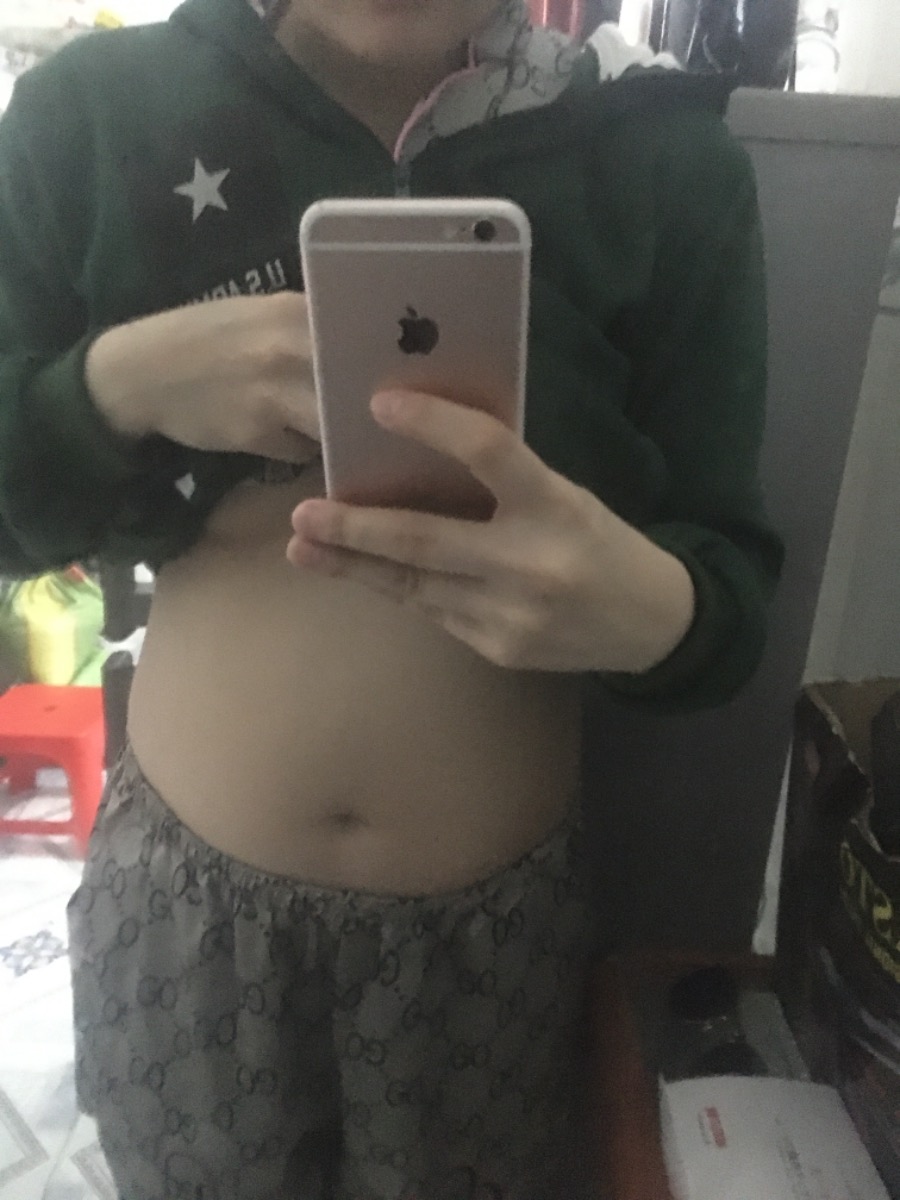 Cho e hỏi e dc 19 tuần mà theo doi app e bé dc 300g ai cũng noi’ e bụng nhỏ hết vay e bé có suy dinh dưỡng kg ạ