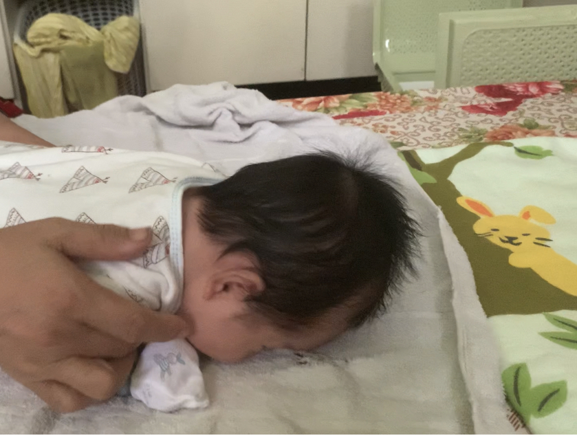 Các chị ơi em mới phát hiện con em bị đầu bẹt 😭😭😭 lúc sinh ra bé đã bị như vậy, nay gần 2 tháng vẫn không thấy đỡ hơn. Đầu này có ảnh hưởng trí thông minh trẻ không ạ 😭😭😭