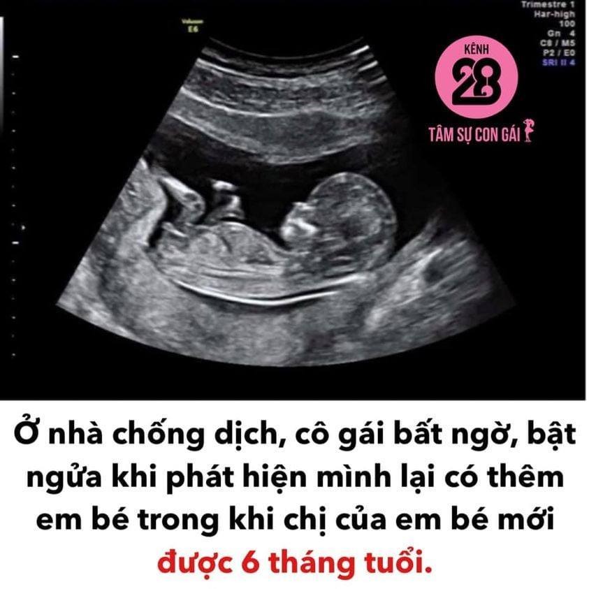 GÓC ĂN VỚI ĐẺ.

Năm ngoái khi dịch bùng thì em nghỉ ở nhà chống dịch luôn không đi làm nữa, vợ chồng em cưới nhau được 4 năm mà vẫn chưa có em bé, nên nghỉ dịch ở nhà đi khám rồi chạy chữa luôn.

2 vợ chồng quyết định ở nhà 1 tháng cho tâm lý thoải mái rồi mới đi khám và nằm viện chữa bệnh, trước đó bác sỹ có nói chồng em bị yếu tt, còn em bị nang buồng trứng, khả năng mang thai tự nhiên là rất thấp.

Ở nhà được 1 tháng, rồi dịch lại ở thêm tháng nữa là 2 tháng, rồi mẹ chồng em bảo đợi dịch bớt bớt hãy đi nằm viện, vợ chồng ở nhà 3 tháng trời chỉ có ăn với ngủ rồi thi thoảng ấy ấy cho vui.

Đến khi đi viện khám thì vợ chồng em suýt nữa thì xỉu luôn khi bác sỹ báo đã có em bé được 6 tuần tuổi, em mừng rớt nước mắt, chồng em thì ôm lấy giấy siêu âm khóc tua tua.

Đầu năm nay em vừa sinh em bé, sinh xong lại dịch, lại cách ly, do cơ địa khó mang thai, bác sỹ bảo lần trước mang thai được đúng là kỳ tích, nên vợ chồng em thi thoảng vẫn làm nháy mà không dùng biện pháp gì. Hôm nay em thấy mệt mệt trong người, mới mua que về thử, thì em suýt xỉu lần nữa vì que báo 2 vạch, em ra mua que nữa thì vẫn 2 vạch, 2 vợ chồng em đúng kiểu mừng rớt nước mắt, mừng không có gì tả được.

Nhưng mừng xong lại lo, vì bé chị còn nhỏ quá, sẽ rất thiệt thòi, nhưng không sao, trời đã thương đã cho chúng em có thêm con, chúng em nhất định sẽ chăm con và yêu thương con thật tốt, để con trở thành đứa trẻ hạnh phúc nhất.

Các chị mà hiếm muộn thì đừng sợ gì cả nha, cứ thoải mái và xxx trong niềm hân hoan, vui vẻ thì con sẽ đến với các chị thôi ạ 😘😘😘
--------------------
Cre: Tâm sự con gái