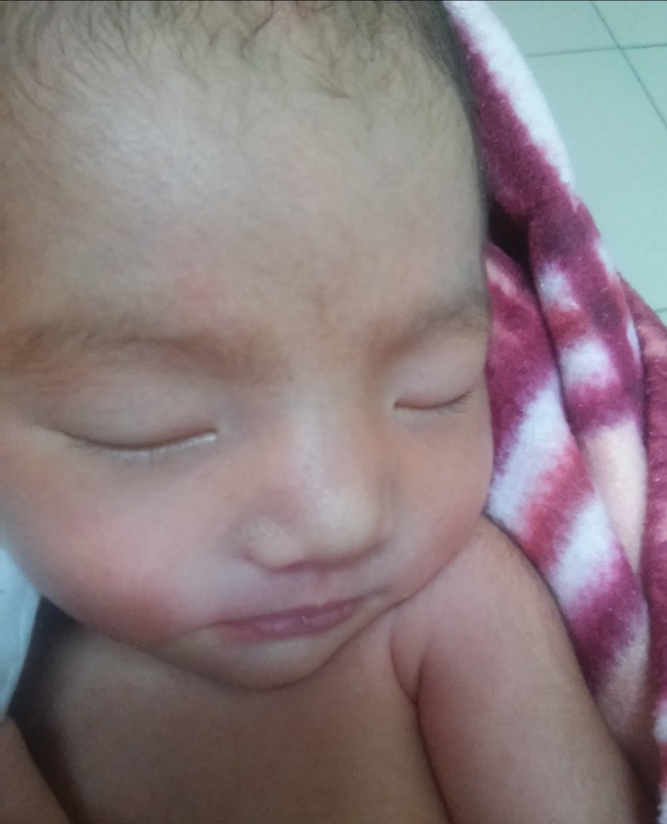 EM BÉ 2,2kg CỦA MẸ
Trước đây mình học sư phạm ra trường mãi không xin được việc, cứ muốn ổn định công việc đã mới nghĩ đến chuyện lập gia đình, nhưng 6 năm kể từ khi ra trường vẫn không xin được việc nên mình đành chấp nhận đi làm công nhân và 30 tuổi mình mới lấy chồng.
 Năm đầu tiên do gặp vấn đề về sức khỏe nên 2 vợ chồng kế hoạch 1 năm, năm sau mới bắt đầu thả.
Nhưng thả 1 mà không thấy gì, mình bắt đầu lo lắng, 2 vợ chồng đến bệnh viện khám, kết quả chồng mình tinh trùng di động hơi yếu, mình bị tắt 1 bên vòi trứng, bác sĩ hẹn 3 tháng sau không có thì tái khám. Mình thật sự lo lắng, lên mạng tìm hiểu các thứ, rồi mình đi bốc thuốc bắc uống, may sao hơn 1 tháng sau mình có bầu, phải nói là 2 vợ chồng mừng lắm. Nhưng khoảng 3h sáng, tự nhiên thấy lạ lạ, mình đi vệ sinh thì thấy quần trong dinh máu, mình tái mặt chạy vô nói với chồng, chồng mình nói không sao đâu, chút sáng vô bệnh viện kiểm tra. Nhưng máu ra nhiều hơn, bác sĩ nói bị sảy thai tự nhiên rồi, khi đó thai mới 7 tuần, mình khóc như mưa, rồi mọi người động viên, sẩy rồi dễ có lại lắm, mình cũng nghĩ vậy. Nhưng không, mình cứ đợi tháng mày qua tháng khác, cứ khi nào gần đến ngày kinh là mình cứ để ý xem cơ thể có gì thay đổi không, nhưng chẳng thấy gì. Mọi người thì cứ dị nghị, nhất là ở quê, đi đâu họ cũng hỏi, sao lâu vậy, lo làm giàu à, sao không đẻ cho rồi...thật sự nhiều khi mình thấy bế tắt, đêm nào mình cũng suy nghĩ chuyện con cái, rồi khóc thầm, rồi mặc cảm với nhà chồng, mình sợ nghe tin ai đó có tin vui😥😥. Những ai đã từng hiếm muộn mới hiểu được cảm giác này.
Mình cố gắng chạy chữa khắp nơi, thuốc tây, thuốc bắc, thuốc nam gì cũng có, 2 vợ chồng bàn nhau cố gắng thêm năm nữa không có thì bán hết số nữ trang cưới đi làm ivf. Chồng mình vẫn luôn động viên, nếu không có con thì 2 vợ chồng mình ở vậy cũng được, coi như cái số mình nó vậy. Mặc dù buồn, lo lắng, ap lực nhưng mình vẫn luôn có niềm tin rồi vợ chồng mình sẽ có con.
Nhưng cũng may trời thương, đúng 2 năm sau bé đầu bỏ mình đi, mình lại nhìn thấy 2 vạch, phải nói là vừa vui sướng vừa lo lắng, sợ như lần trước. Mình quyết định nghĩ làm ở nhà dưỡng thai. Rồi đến 32tuần nửa đêm đột nhiên đầu mình bị quay cuồn, nôn mửa, không đi được, chóng mặt đi là ngã, rồi mình đi cấp cứu trong đêm, thật sự hoang mang, chỉ mong sao con mẹ vẫn khỏe, rồi bác sĩ kết luận do bầu thiếu ngủ nên bị rối loạn tiền đình, mình nằm viện 3 ngày rồi được về nhà, một phen hú vía.
Nhưng không dừng lại ở đây, lúc thai được 34tuần thì mình rỉ ối, tự nhiên nó chảy ra như mình đi tiểu vậy. Rồi vô bệnh viện cấp cứu, bác sĩ nói giờ rỉ ối rồi để lâu sẽ nhiễm trùng nguy hiểm, mà sinh bé lúc này cũng rất nhiều nguy cơ chảy máu não, suy hô hấp...nhiều lắm mà lúc đó mình không còn tâm trạng để nghe. Họ cho mình tiêm trưởng thành phổi, truyền giảm co được 2 ngày nhưng e bé gò càng nhiều, nên không truyền nữa, bác sĩ bảo giờ sinh thôi chứ không giữ thêm được nữa. Lúc đó mình lên bàn sinh rồi mà ông bác sĩ trẻ trẻ còn hù mình thêm 1 lần nữa nói e bé nhiều khi sinh ra sẽ bị như thế này thế kia, tệ hơn nữa là không sống được...mình khóc nức nở, trời ơi, mình đã hiếm muộn rồi, khó khăn lắm mới có thai, sao lại bị như thế này nữa, nhưng mình cố giữ bình tĩnh, lấy sức để rặn chứ giờ mà mình buông xuôi thì con mình sẽ ra sao. Lần đầu tiên mình biết cảm giác vừa đau đẻ vừa sợ hãi. Sau một hồi được sự hỗ trợ của bác sĩ và 3 y tá, bé mình cũng chào đời, được 2,2kg. Chưa được nhìn mặt con thì y tá đã ẩm con đi rồi. Mình về phòng hậu sản nằm, thấy mẹ nào cũng có bé bên cạnh mà mình thì không, tủi thân vô cùng, không biết con mình thế nào.
3 ngày sau mình xuất viện nhưng con mình vẫn còn nằm lồng kính, 1 tuần sau bệnh viện mới cho gọi mẹ lên tập cho con bú. Lần đầu tiên nhìn thấy con sau gần 10 ngày sinh, cảm giác thật khó tả, lúc đó mình luống cuống không biết bồng con như thế nào, bé thì quá nhỏ mình chỉ bồng đại theo bản năng. Được ôm con vào lòng sau hơn 4 năm ròng rã thật sự không gì hạnh phúc bằng, cũng may bé mình sinh non nhưng vẫn phát triển bình thường, giờ bé sắp sinh nhật lần thứ 3, nhìn con mà thầm cám ơn ông trời đã đưa con đến bên mẹ. Mình luôn cầu mong cho những mẹ hiếm muộn sẽ được làm mẹ như mình. Các bạn phải luôn có niềm tin là  mình sẽ được làm mẹ nhé😘😘