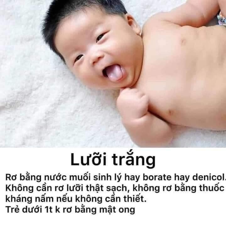 Mẹo vặt cho bé yêu 👌👌👌
Các mẹ cùng chia sẻ để các bố và mọi bà mẹ sau sinh được biết nhé!!!
