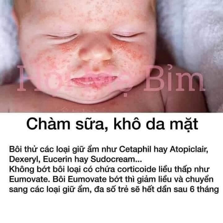 Mẹo vặt cho bé yêu 👌👌👌
Các mẹ cùng chia sẻ để các bố và mọi bà mẹ sau sinh được biết nhé!!!
