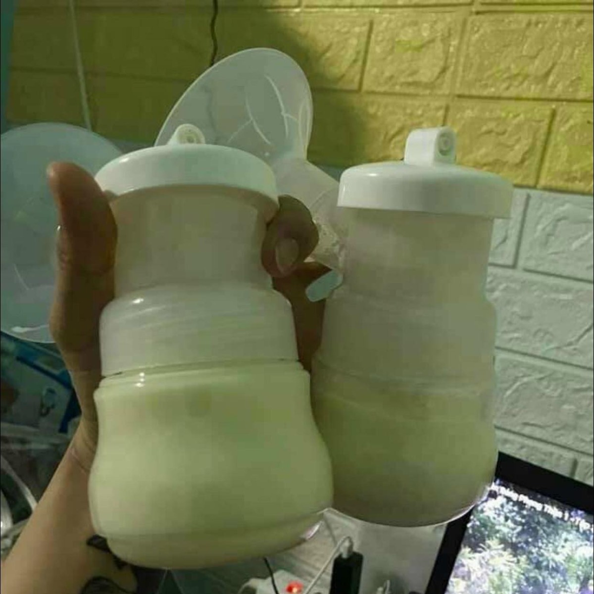 CƯƠNG SỮA SINH LÝ SAU SINH

Hiện tượng cương sữa sinh lý sau sinh hay còn gọi là tắc sữa toàn tuyến sau sinh xảy ra bắt đầu từ ngày thứ 3 và có thể kéo dài đến ngày thứ 6, 7, 8 sau khi bé ra đời, rất thường gặp ở các mẹ.

Khi bị cương sữa sinh lý sau sinh, mẹ sẽ cảm thấy căng tức ngực và đau nhức cả bầu ngực (không có cục). Có mẹ còn bị sốt và hiểu lầm là mình bị tắc sữa. Hiện tượng cương sữa này rất dễ nhầm với tắc sữa (xảy ra trong quá trình nuôi con bằng sữa mẹ sau này).

Nguyên nhân xảy ra cương sữa sinh lý là vì: Qua giai đoạn 72h vàng sữa non, do tác động của sự thay đổi hormone, hệ thống ống tuyến trong bầu vú mẹ bắt đầu giãn nở để chuẩn bị làm bể chứa cho sữa già được tiết ra mỗi lúc một nhiều. 

Hệ thống mạch máu trong bầu vú cũng giãn nỡ để tăng tuần hoàn đẩy nhanh quá trình tạo sữa và tiết sữa. Sự giãn nỡ quá mức của hệ thống ống tuyến và hệ thống mạch máu trong bầu vú tạo nên cảm giác căng tức và đau nhức.

Mẹ nên xử lý cương sữa sinh lý sau sinh như thế nào?

- Các mẹ không được chườm nóng. Việc chườm nóng sẽ làm cho hệ thống ống tuyến và mạch máu ở vú càng giãn nỡ, hệ quả là các mẹ sẽ càng thấy căng tức và khó chịu hơn.

- Tuyệt đối ko được day bóp, tác động mạnh gây tổn thương ngực.

- Ngược lại, các mẹ hãy chuẩn bị 2 chai nước lạnh lăn khắp bầu ngực trong vòng 20 đến 30p kết hợp massage nhẹ nhàng.

Trong quá trình điều trị cương sữa sinh lý, quan trọng nhất là cách massage đầu ti để làm mềm đầu ti và kích thích tiết oxytocin. Các mẹ nên học cách vắt sữa bằng tay để tự vắt làm giảm áp lực lên bầu ngực trong khi máy hút sữa chưa thể hút sữa ra một cách bình thường.

Ngoài thời gian massage bằng tay các mẹ có thể úp phễu hút sữa lên và bật chế độ massage hoàn toàn ở mức nhỏ nhất.

Cách massage này cực kỳ có tác dụng:
- Dùng lòng bàn tay áp vào đầu ti và xoa tròn đều để đầu ti lăn trong lòng bàn tay, dùng đầu ngón trỏ xoa nhẹ vào phần quầng thâm để cơ thể cảm thấy buồn buồn và tạo hormone tiết sữa.

- Dùng 2 đầu ngón tay cái ấn nhẹ và massage tại vị trí quầng thâm và đầu ti. Nắm chặt nắm tay vuốt nhẹ nhàng từ đầu ti vào trong góc ngực, nách. Sau đó vắt tay cho đỡ áp lực trong ngực và cho con bú.

- Quy trình xử lý lặp lại nhiều lần trong vòng 1 đến 2 ngày sẽ khỏi. Các mẹ không nên quá lo lắng nhé.

Một tip nhỏ cho các mẹ: Giai đoạn này có thể uống thêm lá bồ công anh để làm giảm sự cương sữa sau sinh, ra sữa tốt hơn. Nếu mẹ nào có lá bồ công anh tươi thì càng tốt nha.