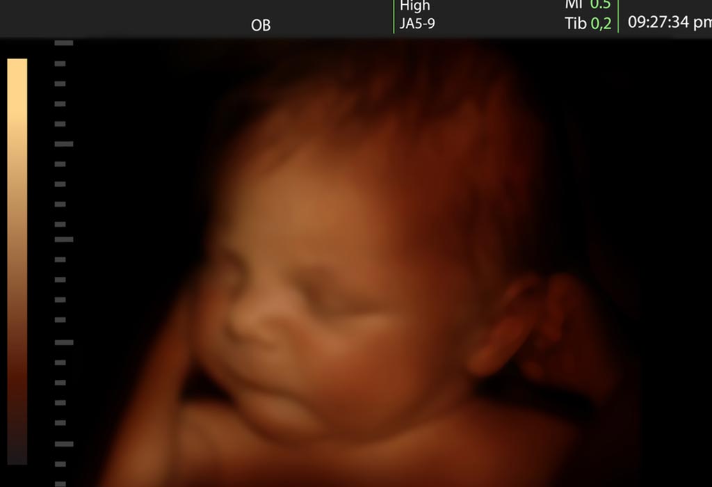 THAI NHI KHÓC TRONG BỤNG MẸ: NHỮNG ĐIỀU THÚ VỊ CÓ THỂ MẸ CHƯA BIẾT 

Thai nhi trong bụng mẹ có thể làm được nhiều hơn những gì bố mẹ nghĩ, bao gồm cả việc khóc. Bài viết dưới đây sẽ giúp bạn biết thêm nhiều điều thú vị về hiện tượng thai nhi khóc trong bụng mẹ: 

- Thai Nhi Thường Phản Ứng Thế Nào Khi Còn Trong Bụng Mẹ?
- Điều Gì Xảy Ra Khi Một Đứa Trẻ Khóc?
- Thai Nhi Trong Bụng Mẹ Có Khóc Không?
- Biểu Hiện Quan Sát Được Khi Thai Nhi Khóc Trong Bụng Mẹ
- Tiếng Khóc Thai Nhi Như Thế Nào?
- Khi Nào Thai Nhi Bắt Đầu Khóc Trong Bụng Mẹ?

Mẹ có thể đọc chi tiết bài viết tại >>> https://mamibabi.com.vn/news/1287/thai-nhi-khoc-trong-bung-me-va-nhung-dieu-thu-vi-co-the-me-chua-biet
 
#thaigiao #thai_giáo #thaigiáo #mangthai #babau