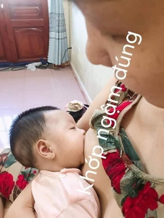 KHỚP NGẬM ĐÚNG

Biểu hiện khớp ngậm đúng cho con bú:
- Miệng há to, 2 môi bé trề
- Cằm chạm ngực
- Mũi hở
- Bé ngậm quầng vú chứ không chỉ ngậm núm vú. Bé sẽ ngậm quầng vú dưới nhiều hơn quầng vú trên
- Lưỡi bé le ra, phủ phần nướu dưới của bé

VÌ SAO PHẢI CÓ KHỚP NGẬM ĐÚNG?

– Núm ti mẹ chỉ có các ống dẫn sữa trong khi các nang chứa sữa lại nằm khu vực quầng vú trở về sau. Vì vậy, nếu bé chỉ ngậm núm vú, bé chỉ rút được lượng sữa trong các ống dẫn sữa.

Nếu bé ngậm sâu quầng vú, bé có thể ép các nang sữa, để đưa sữa vào miệng.

– Vậy bú đúng thì phải ngậm cả quầng vú, chứ không chỉ ngậm có núm vú.

NẾU KHỚP NGẬM KHÔNG ĐÚNG THÌ SAO?

1. Bé không nút được sữa một cách hiệu quả, cữ bú có thể kéo dài lâu mà bé vẫn cứ đói và đòi bú.

-> Vì không rút được tối đa lượng sữa có trong ngực, cơ thể sẽ hiểu sữa còn trong ngực là sữa dư, sản lượng sữa sẽ bị giảm dần, mẹ phải bổ sung thêm sữa công thức.

-> Nếu khớp ngậm không được điều chỉnh, lâu dài bé không nhận đủ lượng sữa, bé sẽ tăng cân không tốt

2. Mẹ bị đau đầu ti, tổn thương lâu ngày có thể làm mẹ vì đau quá mà giảm số lần cho con bú, từ đó sản lượng sữa bị giảm, tăng nguy cơ bé phải bú sữa công thức.