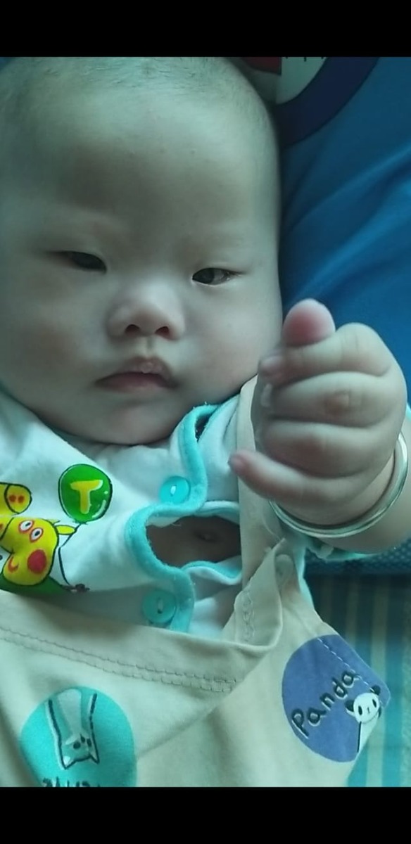 Con yêu à.hành trình có con là ba mẹ gian nan nhất.khi biết tin có bầu ba mẹ vui biết giường nào đến w12 mẹ sâ dmdg con cao bs bảo lên Từ Dũ luôn,khám xong ba chở mẹ về mà khóc không ngừng được.Và rồi lên Từ Dũ bs sâ con bất sản xương mũi chẩn đoán hội chứng Đown mẹ đau lắm con biết ko.Mẹ ko chọc ối vì mẹ ko muốn bỏ con và lương tâm mẹ ko cho phép điều đó.những lần sâ tiếp theo con có nang bạch huyết mẹ sợ con bỏ ba mẹ đi bất cứ lúc nào.mẹ lúc đó chỉ biết cầu nguyện và mong con bình an như nào mẹ cũng nuôi thôi.và ngày con đến với mẹ khi bước sang tuần 37.con ra đời ba mẹ vui lắm và rồi chuyện j đến cũng đêna con bị vàng da phải chuyển tới nhi đồng bs nghi ngờ con bị đown mẹ đau lắm...Hiện tại mẹ đã chấp nhận sự thật rồi,tuy con ko may mắn nhưng mẹ sẽ bù đắp mọi thứ cho con.con ko hoàn hảo nhưng mẹ sẽ đồng hành cùng con trên cuộc đời này ...con cũng đáng yêu lắm mọi người ạ.cũng may bé nhà e ko có bệnh đi kèm cũng là may mắn hơn 1 số bé giống bé e.mẹ yêu con cò non của mẹ lắm.yêu em🥰🥰♥️♥️biết rằng trc mắt còn khó khăn và thử thách nhuqng mẹ sẽ cố gắng vì con