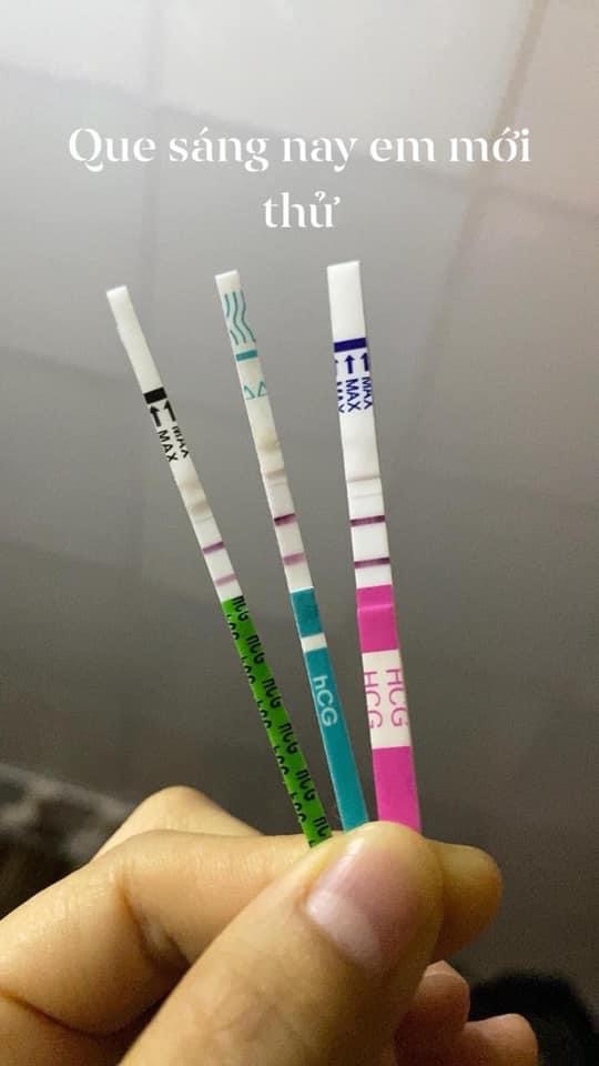 Mọi người ơi. E kinh nguyệt k đều, ckk dài 50-55 ngày. E tự canh trứng đc 2 vạch đậm là vc e quan hệ lần cuối cùng là ngày 29,30/9 và 2/10 . Và time đó đến nay e thử que có lên vạch mờ đến nay cũng đã lên vạch đậm. Đi siêu âm nhưng chưa thấy gì. Xét nghiệm beta lên 206 . Nhưng chờ ngày siêu âm để xem thai vào tổ chưa. Thì tối qua em bị ra chút xíu máu tươi ở quần lót. Em lo quá. Chờ đến sáng e có thử que vẫn lên vạch đậm. Sợ bị xẩy thai nên sáng nay em đã đi khám. Kết quả là có túi thai nhưng bị nằm ở đáy tử cung lệch phải ạ. Bs nói em về nghỉ ngơi để theo dõi thêm. Còn bảo nếu đi khám sớm thì nằm ngoài tử cung có thể điều trị sớm để bỏ. Còn bây giờ nó vào trong tử cung r nhưng nằm ở góc gần ngoài tử cung. Nên rất khó xử lý. Mn đã ai từng bị như em chưa. Có ai giống em nhưng thai vẫn sẽ di chuyển vào trong lòng tử cung k ạ? Hãy nói cho em k lo lắng đi ạ. E mong con 2 năm rồi chưa có bé nào gặp nv e lo quá các mom ạ.