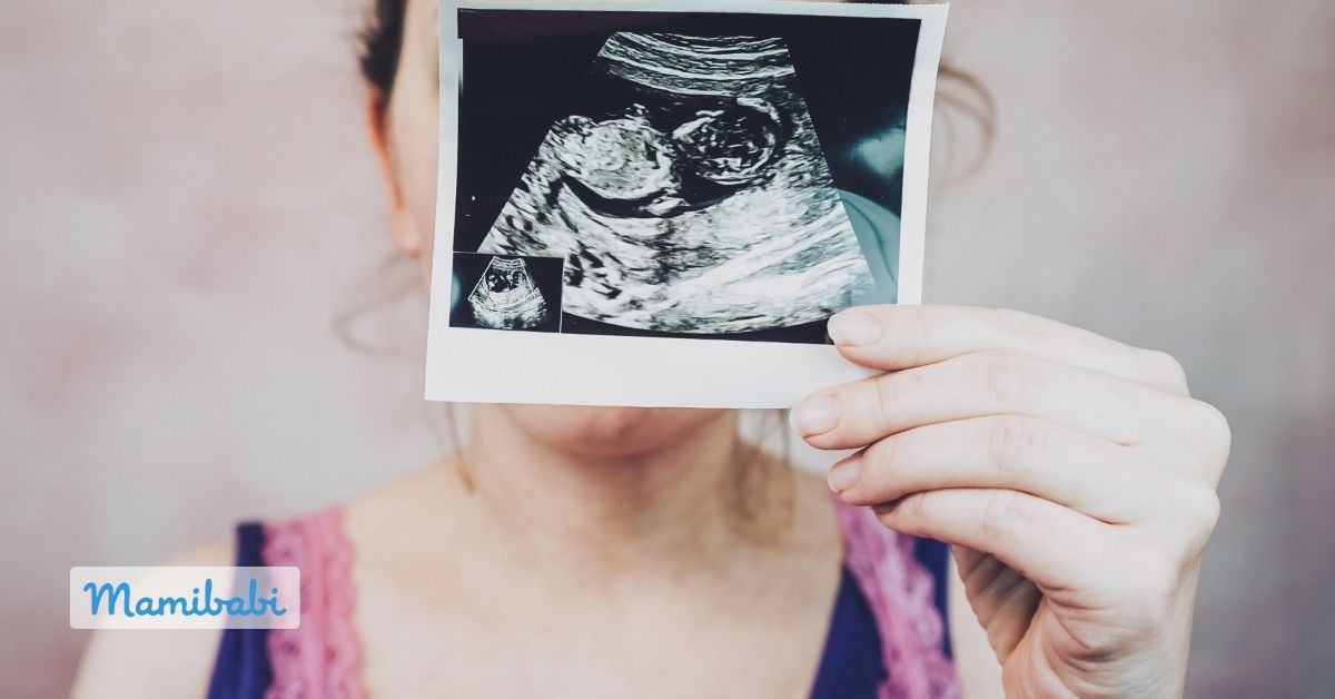 Chuẩn bị trước khi mang thai