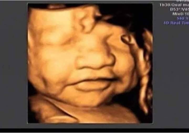 Có ai xin vía má lúm k ạ 😂😂😂
E dc 34w rồi hqua đi siêu âm bsi bảo to quá mẹ hãm ăn lại k ăn dao 😥😥. Đc 2kg6 rồi