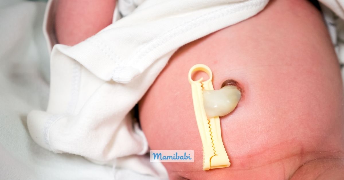 Chăm sóc rốn cho bé