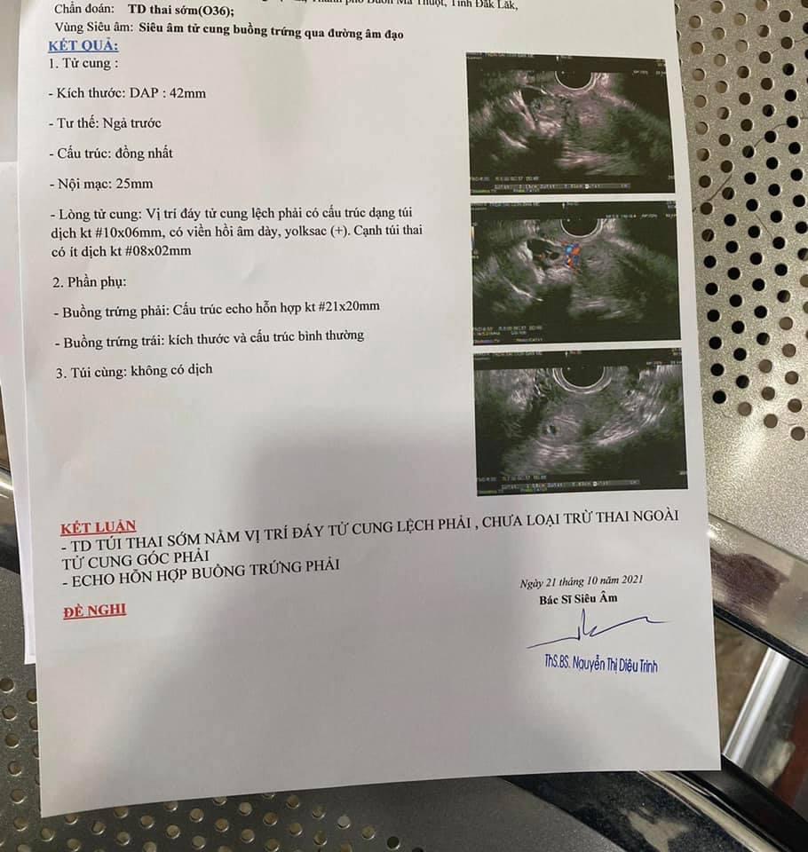 Mọi người ơi. E kinh nguyệt k đều, ckk dài 50-55 ngày. E tự canh trứng đc 2 vạch đậm là vc e quan hệ lần cuối cùng là ngày 29,30/9 và 2/10 . Và time đó đến nay e thử que có lên vạch mờ đến nay cũng đã lên vạch đậm. Đi siêu âm nhưng chưa thấy gì. Xét nghiệm beta lên 206 . Nhưng chờ ngày siêu âm để xem thai vào tổ chưa. Thì tối qua em bị ra chút xíu máu tươi ở quần lót. Em lo quá. Chờ đến sáng e có thử que vẫn lên vạch đậm. Sợ bị xẩy thai nên sáng nay em đã đi khám. Kết quả là có túi thai nhưng bị nằm ở đáy tử cung lệch phải ạ. Bs nói em về nghỉ ngơi để theo dõi thêm. Còn bảo nếu đi khám sớm thì nằm ngoài tử cung có thể điều trị sớm để bỏ. Còn bây giờ nó vào trong tử cung r nhưng nằm ở góc gần ngoài tử cung. Nên rất khó xử lý. Mn đã ai từng bị như em chưa. Có ai giống em nhưng thai vẫn sẽ di chuyển vào trong lòng tử cung k ạ? Hãy nói cho em k lo lắng đi ạ. E mong con 2 năm rồi chưa có bé nào gặp nv e lo quá các mom ạ.