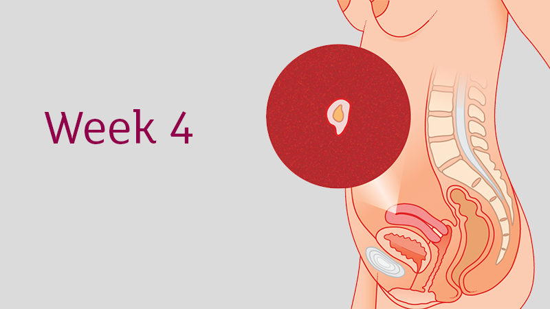 HÌNH ẢNH THAI NHI 4 TUẦN TUỔI VÀ NHỮNG ĐIỀU CẦN BIẾT 
 
Rất nhiều mẹ đã gửi tới Mamibabi những thắc mắc liên quan đến thai nhi 4 tuần tuổi như:

- Hình ảnh thai nhi 4 tuần tuổi trông như thế nào?
- Kích thước thai nhi 4 tuần tuổi là bao nhiêu?
- Thai nhi 4 tuần tuổi đã vào tử cung chưa?
- Thai nhi 4 tuần tuổi có phá được không?
- Phá thai 4 tuần tuổi có tội không?
- Thai 4 tuần chưa có phôi có đáng lo không?
- Thai nhi 4 tuần có tim thai chưa?
- Thai 4 tuần nên ăn gì?
 
Và dưới đây là giải đáp của anh Phạm Ngọc Thắng, nhà sáng lập ứng dụng thai giáo Mamibabi, tác giả cuốn sách “Rủ chồng thai giáo”, đồng thời là chuyên gia thai giáo nam giới đầu tiên tại Việt Nam.
 
👶 HÌNH ẢNH THAI NHI 4 TUẦN TUỔI TRÔNG NHƯ THẾ NÀO?

Xin được chúc mừng mẹ đã bước đến tuần thứ 4 của thai kỳ. Đây là một cột mốc rất đáng nhớ bởi lúc này quá trình thụ tinh đã được hoàn thiện rồi và phôi thai đã được hình thành. 

Mẹ lưu ý ở tuần này con mới chỉ là phôi thai thôi chứ chưa phải là thai nhi nhé. 

Ở thời điểm thai 4 tuần tuổi, các cơ quan nội tạng của con bắt đầu phát triển và hoạt động. Có 2 bộ phận rất quan trọng đối với con, đó là màng ối và túi noãn hoàng. Màng ối chứa đầy nước ối, tạo thành một lớp đệm bồng bềnh để bảo vệ con, đó giống như một cái bể bơi của riêng con để con thỏa thích vẫy vùng vậy. Còn noãn hoàng sẽ tạo máu và nuôi dưỡng con trong những tuần đầu tiên của thai kỳ, còn sau đó nhau thai sẽ thay thế.  

👶 KÍCH THƯỚC THAI NHI 4 TUẦN TUỔI LÀ BAO NHIÊU? 

Phôi thai 4 tuần tuổi có khối lượng khoảng 1g và kích thước khoảng 4mm, tức là bé li ti như một hạt vừng.

👶 THAI NHI 4 TUẦN TUỔI ĐÃ VÀO TỬ CUNG CHƯA?

4 đến 6 tuần là thời điểm mẹ cần đi siêu âm lần đầu tiên. Mặc dù phôi thai đã được hình thành nhưng vì con còn quá nhỏ nên mẹ sẽ chưa thể nhìn thấy gì cả. Tuy vậy, siêu âm lần đầu luôn đem lại những cảm giác rất thú vị. Mẹ sẽ được biết chắc chắn rằng mình đã có thai, biết kích thước túi ối ở trong khoảng 3 - 5mm, biết vị trí làm tổ của thai, nhưng thường thì thai 4 tuần tuổi chưa làm tổ đâu các mẹ nhé. 

Thể trạng mỗi mẹ mỗi khác, thời gian thụ thai và làm tổ cũng sẽ nhanh chậm khác nhau. Vì vậy nếu siêu âm ở thời điểm 4 tuần thấy thai chưa làm tổ thì mẹ cũng đừng lo lắng quá mà hãy chờ đợi thêm.

👶 THAI NHI 4 TUẦN CÓ TIM THAI CHƯA?

Với một số mẹ, thai 4 tuần có thể đã làm tổ, nhưng vẫn chưa có tim thai đâu các mẹ nhé. Tim thai thường sẽ xuất hiện vào tuần thứ 6, 7 của thai kỳ. Lần đầu tiên vợ chồng mình nghe tim thai của con là khi được 8 tuần. Đó là một cảm xúc rất tuyệt vời xen lẫn diệu kỳ. Thế nên các mẹ hãy chờ thêm một vài tuần nữa để được nghe nhịp tim thai của con nhé! 
 
👶 THAI 4 TUẦN CHƯA CÓ PHÔI CÓ ĐÁNG LO KHÔNG?

Có một vấn đề khiến nhiều mẹ rất lo lắng, đó là thai 4 tuần nhưng chưa có phôi thai thì liệu có nguy hiểm không, thậm chí có mẹ còn bảo mình là lo lắng đến mất ăn mất ngủ. Khi đọc tin tức trên mạng các mẹ thường thấy thai 3, 4 tuần là đã có phôi thai rồi, thành ra thấy mình chưa có thì hoang mang lắm. Nhưng điều đó là bình thường các mẹ nhé. 

Có những trường hợp tuần thứ 5, 6 mới thấy phôi thai cơ. Thêm một điều nữa là khi đi khám, nếu có lo lắng gì các mẹ cũng nên hỏi bác sĩ ngay cho an tâm nhé. 
 
👶 DẤU HIỆU SẢY THAI 4 TUẦN TUỔI

Có một vấn đề khác đáng lo hơn cả việc chưa có phôi thai, đó là sảy thai 4 tuần tuổi. Chắc hẳn mẹ nào cũng biết rằng 3 tháng đầu là thời gian nhạy cảm và dễ sảy thai nhất đúng không ạ. Một số dấu hiệu điển hình của việc sảy thai là chảy máu âm đạo, đau lưng, đau bụng dưới… Tuy nhiên, không phải cứ có những dấu hiệu đó thì là sảy thai các mẹ nhé, có những khi chỉ là dọa sảy thôi. Và khi đó các mẹ cần đi khám ngay để đảm bảo an toàn cho thai nhi. 
 
👶 THAI NHI 4 TUẦN TUỔI CÓ PHÁ ĐƯỢC KHÔNG? PHÁ THAI 4 TUẦN TUỔI CÓ TỘI KHÔNG?

Có một câu hỏi thỉnh thoảng mình lại thấy hiện lên trong các comment, đó là phá thai 4 tuần có sao không hoặc có tội không. Thường thì người hỏi là các bạn còn rất trẻ, không may có thai ngoài ý muốn, hoặc là các mẹ không may bị nhỡ, bị vỡ kế hoạch, hoặc sợ đẻ ra mình không nuôi được con.

Thật lòng mình không bao giờ ủng hộ việc phá thai các mẹ nhé, vì như thế thật sự rất tội nghiệp các con. Rất nhiều người muốn có một đứa con mà không được, vì vậy việc bạn có con thật sự là một tài sản vô giá nên đừng bỏ con nhé. Với các bạn trẻ không may có thai ngoài ý muốn, mình biết có những bạn không muốn phá nhưng bị gia đình bắt phá, hoặc không có tiền sinh con, không có chỗ ở. 

Hiện nay có rất nhiều tổ chức từ thiện sẵn lòng cưu mang và giúp đỡ để các bạn có thể sinh con ra mà không phải phá thai, vì vậy hãy can đảm giữ con lại nhé. Và nếu bạn nào cần sự giúp đỡ thì có thể nhắn tin cho mình, mình có thể giới thiệu với các bạn những tổ chức từ thiện mà mình biết. 

👶 THAI GIÁO TUẦN THỨ 4

Để con phát triển tốt nhất và mẹ có một thai kỳ vui nhất thì các mẹ đừng bỏ qua việc thai giáo mỗi ngày cho con nhé. 

Việc đầu tiên mẹ nên làm là đặt cho bé một cái tên dễ thương. Nếu bé yêu chưa có tên gọi ở nhà, bố mẹ hãy đặt cho bé một cái tên. Việc này sẽ giúp quá trình thai giáo 40 tuần hiệu quả hơn. Hàng ngày, bé sẽ được nghe bố mẹ gọi tên mình, cảm thấy gần gũi và thân quen hơn với bố mẹ. Hình thức thai giáo ngôn ngữ này giúp bé phát triển ngôn ngữ và chỉ số cảm xúc tốt hơn.

Việc thứ 2 mẹ nên làm là sắp xếp lại nơi ở. Môi trường sống ảnh hưởng rất lớn đến sức khỏe mẹ bầu và thai nhi. Khi có thai 4 tuần, mẹ hãy dành thời gian kiểm tra xem phòng của mình có cần dọn dẹp hay chỉnh sửa không nhé. Mẹ nên đảm bảo phòng được lau dọn sạch sẽ thường xuyên, đồ đạc sắp xếp ngăn nắp để có thể tìm kiếm dễ dàng, không có các đồ vật dễ gây vấp ngã khi mẹ di chuyển, hạn chế để chung hàng hóa với phòng ngủ của mẹ… Mẹ hãy nhờ tới sự giúp đỡ của người thân trong gia đình để dọn dẹp lại phòng ốc của mình nhé! 

Việc thứ 3 mẹ nên làm là vẽ tranh và tô màu. Đây là hình thức thai giáo mỹ thuật đem lại sự thư giãn rất tốt cho cả mẹ và bé. Việc vẽ tranh cũng là cách thai giáo an toàn cho mẹ trong những tuần đầu mang thai. Mẹ không phải đi lại hay vận động nhiều. Nếu không thích vẽ tranh, mẹ có thể tô màu cùng những cuốn sách tô màu dành riêng cho người lớn. Mỗi ngày, mẹ hãy vẽ tranh theo một chủ đề khác nhau hoặc phối màu theo những phong cách khác nhau. Việc này giúp bé yêu thông minh và có xu hướng yêu nghệ thuật hơn khi trưởng thành.
 
👶 THAI 4 TUẦN NÊN ĂN GÌ?

Thai giáo dinh dưỡng là điều quan trọng nhất mẹ cần quan tâm ở giai đoạn này.

Có 2 việc mẹ nên làm, 1 là khi khám thai, mẹ nhờ bác sĩ tư vấn giúp mình một loại vitamin phù hợp. Mình thấy nhiều mẹ thường tự mua uống hoặc mua theo người quen hay mua theo quảng cáo. Nhưng mình khuyên các mẹ nên đi khám và nghe theo chỉ dẫn của bác sĩ nhé.  

Việc thứ 2 là mẹ nên xem lại các món mình hay ăn và điều chỉnh lại nếu có gì chưa phù hợp với bà bầu. Ví dụ, nếu sáng nào mẹ cũng uống cà phê thì nên bỏ thói quen này. Hoặc nếu uống quá nhiều trà sữa thì cũng nên bớt đi vì trà sữa thường chứa nhiều đường, dễ gây tiểu đường thai kỳ. Hoặc nếu mẹ hay ăn mì gói, bánh kẹo, đồ công nghiệp chứa nhiều chất phụ gia thì cũng nên hạn chế các mẹ nhé. Hãy ưu tiên đồ ăn tươi ngon, rau củ quả thịt cá sạch vẫn là tốt nhất cho cả mẹ và bé đó ạ. 
 
👶 THAI GIÁO VẬN ĐỘNG TUẦN THỨ 4

Về vận động, mẹ nên dành nhiều thời gian nghỉ ngơi và cần cẩn trọng khi làm việc nhà. Làm việc nhà cũng là một hình thức vận động tốt nhưng mẹ nên tránh các tư thế cúi thấp, với tay, bê vác đồ nặng… 
 
#thai_nhi_4_tuần_tuổi
#thaigiao #thai_giáo #thaigiáo #mangthai #babau