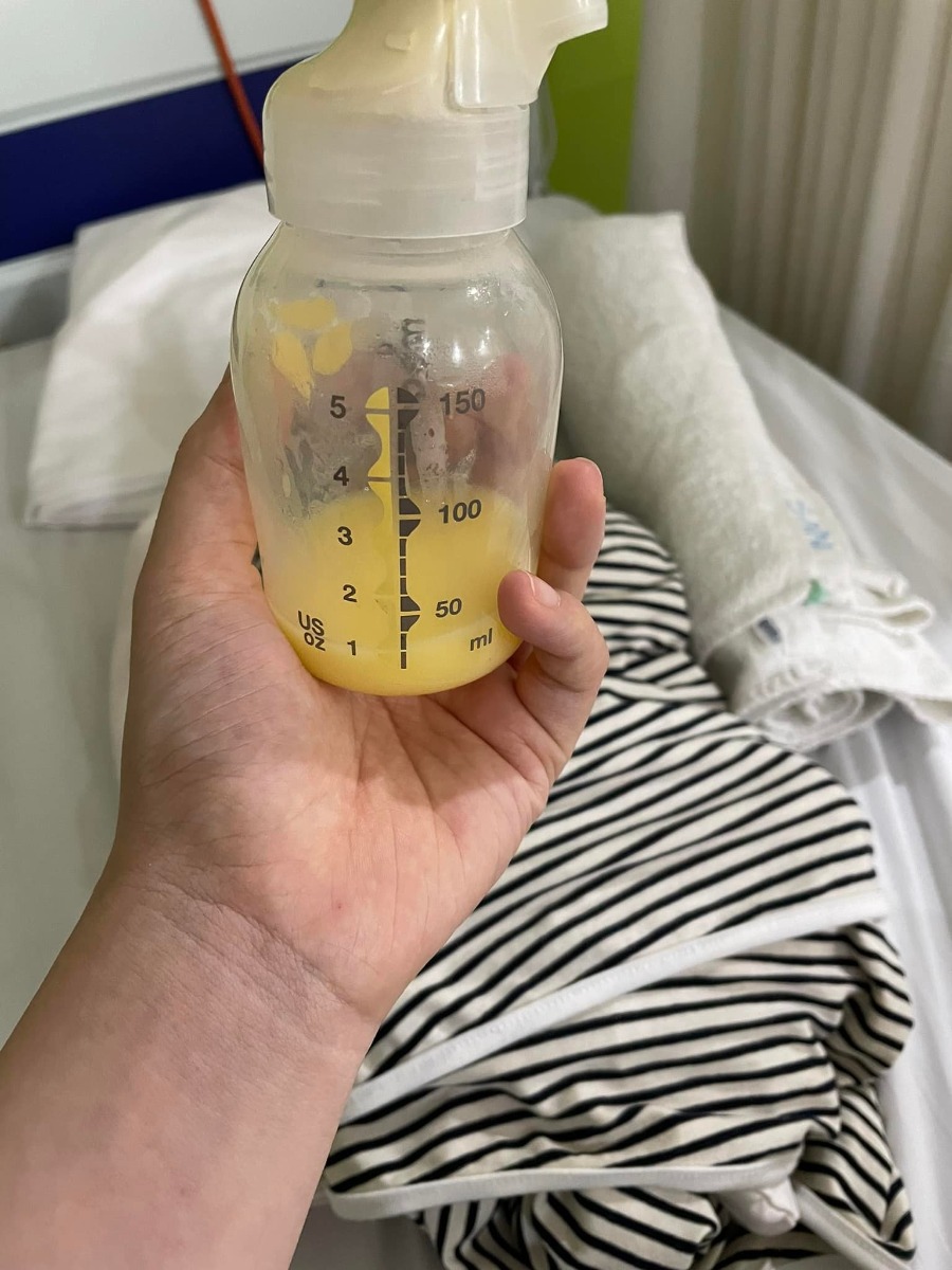 Review sinh mổ ở “khách sạn” Bảo Sơn ạ:
Em sinh mổ bé đầu 2019 ở PSHN theo bảo hiểm, sinh bé thứ 2 muốn chọn viện tư vì bà ngoại còn phải chăm bé đầu, chồng sẽ vào chăm mẹ nên chọn viện tư để các cô chăm sóc cùng. Em chọn gói sinh mổ 36 tuần vì nhà chồng xa viện, không thể đi lại thăm khám tại viện nhiều, và gói 36 tuần em thấy cũng khá đầy đủ các dịch vụ thiết yếu rồi ạ.
- Trước sinh:
Đúng 36 tuần em mới đến viện khám và làm  hồ sơ, được các bạn y tá hướng dẫn rất nhiệt tình, bác sĩ Thảo siêu âm siêu kỹ, siêu nhẹ nhàng với các mẹ bầu, nói chung đội ngũ bác sĩ và y tá ở đây cảm thấy rất gần gũi như người nhà mình, hay hỏi han và tư vấn cho mẹ🥰🥰.
Vết mổ lần 1 của e bị sẹo lồi rất to và xấu, các bác sĩ và y tá đều trấn an “yên tâm sẽ làm lại hết cho đẹp đẽ” 😆😆.
Khi ở nhà, những gì còn thắc mắc e toàn lên page của viện ib thì được trả lời rất nhanh gọn, đặt lịch khám hôm trước hôm sau cũng được sắp xếp rất nhanh nhẹn.
- Khi đi sinh:
Em chọn ngày giờ sinh đúng vào hôm bác sĩ Cốc trực nên em ko mất tiền chọn bác sĩ, với cả đọc review thấy bác nào cũng được khen cả nên em khá yên tâm với đội ngũ bác sĩ ở Bảo Sơn. 2 vợ chồng đặt lịch sinh từ 13h-15h, 11h thủng thẳng dắt nhau tới viện làm các thể loại test và thủ tục, xong xuôi chưa đến giờ thì được vào phòng chờ để nghỉ ngơi. Em lúc đó khá là tâm lý và sợ vì lần trước mổ là mổ cấp cứu ko được chuẩn bị 1 cái gì, nhưng chính tác phong nhẹ nhàng dịu dàng của mọi người ở đây khiến em cảm thấy đỡ sợ hơn.
Khi nằm trên bàn mổ, em cũng thấy bất ngờ vì ekip khá đông, phải đến gần chục người, bác Cốc mổ, bác Huyền khâu, mỗi người 1 công đoạn, nhưng tay làm mà miệng vẫn nói chuyện với nhau khá vui vẻ. Bác sĩ Nhân gây tê cho em nhẹ nhàng hơn rất nhiều, đọc nhiều review tưởng bác là nam nhưng hoá ra là nữ, vừa gây tê bác vừa giải thích, cách nói chuyện trẻ trung, giải thích và theo dõi cho e từ lúc vào phòng mổ, qua cả 3 tiếng hậu phẫu, đến khi em về phòng nghỉ. 
13h30 em bé chui ra khỏi bụng mẹ, các bác sĩ khen bé kháu khỉnh, nhanh nhẹn, cho bé áp má mẹ 3 lần rồi đưa đi da tiếp da với bố. Bé nhà em trộm vía khoẻ mạnh, 3,6kg nên được da tiếp da với bố phải 3 tiếng liền 😃😃.
3 tiếng nằm phòng hậu phẫu có anh Ngọc ngồi theo dõi khá cẩn thận cho em, nằm mơ màng chán chê em quay ra bắt chuyện và nói chuyện sinh nở với anh ý vì thực ra em chả hiểu biết gì mấy về kiến thức sinh nở 😅😅.
- Sau sinh:
Em được đưa về phòng 505, phòng 2 giường, em ở lại viện 4 ngày vì ngày đáng nhẽ ra viện lại ko được ngày nên gia đình quyết định ở thêm, thì 2 ngày cuối giường bên không có người nên 2 vợ chồng tha hồ thoải mái.
Em quyết định ko dùng gây tê ngoài màng cứng giảm đau sau mổ vì lần đầu dùng đã ăn trọn combo não cá và đau lưng, lần này quyết chịu đựng thì công nhận đêm đầu ở viện đau dã man ạ, 3 đêm sau thì đỡ hơn, có dùng viên đút giảm đau nhưng giảm dần liều dùng vì sẽ đỡ nhanh hơn, sinh lần này em còn cảm thấy khoẻ hơn lần mổ đầu vì đi lại leo cầu thang đc, lần mổ đầu em ngồi xe lăn về nhà đấy ạ 🥲🥲.
Đồ ăn tại viện thì không chê vào đâu được ạ, em đã nằm khá nhiều viện tư nhưng Bảo Sơn đưa suất ăn khá đầy đặn và nhiều bữa 😘😘.
Về vấn đề vệ sinh cho mẹ, các y tá làm khá nhẹ nhàng và kỹ càng, cứ hỏi là được giải đáp, chỉ bảo rất tận tình.
Về vấn đề sữa, u Sinh và các bác sĩ, y tá đi thăm suốt ngày, kiểm tra xem sữa về chưa, về được bao nhiêu, cần matxa kích sữa thêm không, nhờ vậy mà sau 2 ngày em đã có sữa cho con bú 😍😍. 
Khi ra viện, em phát sinh phí lưu viện thêm 1 ngày 1tr800k, xét nghiệm máu gót chân cho bé 800k, khám thính lực 200k, bảo hiểm y tế Nhà nước trả cho 2tr200k. 
Hôm nay bé nhà em được 13 ngày trộn vía khoẻ mạnh vui vẻ, mẹ khoẻ hơn lần sinh đầu rất nhiều, sữa về ổn, đặc biệt vết mổ bé xíu gần như ko thấy gì 😁😁
Em xin cảm ơn các bác sĩ, y tá tại “khách sạn” Bảo Sơn rất nhiều ạ🥰🥰, nếu có lần 3 thì cũng cứ Bảo Sơn mà thẳng tiến ạ 😍😍