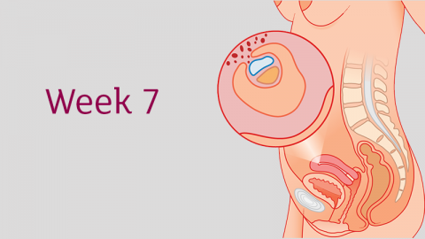 THAI 7 TUẦN: MẸ CẦN LÀM GÌ ĐỂ CON PHÁT TRIỂN TỐT NHẤT? 

Dưới đây là những chia sẻ của anh Phạm Ngọc Thắng, nhà sáng lập ứng dụng thai giáo Mamibabi, đồng thời là tác giả cuốn sách "Rủ chồng thai giáo" về sự phát triển của thai nhi tháng thứ 7: 

💝 THAI 7 TUẦN LÀ BAO NHIÊU THÁNG? 
Thai 7 tuần là lúc mẹ mà bé đang ở tháng thứ 2 của thai kỳ. 

💝 THAI 7 TUẦN KÍCH THƯỚC BAO NHIÊU? 
Lúc này, con nặng khoảng 1g và dài 6 - 10mm, tương đương với một quả việt quất 

💝 THAI 7 TUẦN PHÁT TRIỂN NHƯ THẾ NÀO? 
So với tuần trước, ở tuần này con đã có những thay đổi nhất định, đặc biệt là ở các chi tiết trên khuôn mặt. Con đã bắt đầu có mí mắt nhưng dĩ nhiên bố mẹ sẽ không thể nhìn thấy được vì đây là một chi tiết rất nhỏ, và kích thước cả người con mới chỉ bằng quả việt quất thôi. Mắt của con cũng to hơn so với tuần trước và bắt đầu có màu mắt. Màu mắt này sẽ ngày càng trở nên rõ hơn và thường màu mắt của con sẽ giống với màu mắt của bố mẹ do yếu tố di truyền. Tai của con cũng đang được hình thành, cả ở phần tai bên ngoài lẫn cấu tạo bên trong. Lưỡi của con cũng xuất hiện trong vòm miệng. 

Các ngón tay và ngón chân của con đang dần nhú lên từ bàn tay và bàn chân. Đặc biệt giữa những ngón tay và ngón chân sẽ có màng, giống như màng ở chân vịt vậy, chứ các ngón không tách rời như người trưởng thành đâu mẹ nhé. 

💝 THAI 7 TUẦN BIẾT TRAI HAY GÁI CHƯA? 
Bộ phận sinh dục của con tuy đang phát triển từng ngày nhưng vẫn chưa đầy đủ nên chưa thể biết được giới tính của con. 

💝 THAI 7 TUẦN ĐÃ BÁM CHẮC CHƯA? 
Một câu hỏi quan trọng được nhiều mẹ quan tâm ở tuần này là thai nhi đã bám chắc chưa. Câu trả lời là chưa mẹ nhé, vì con chưa bám chắc nên các mẹ vẫn cần cẩn thận trong sinh hoạt hàng ngày, tránh vận động mạnh! Và đặc biệt các mẹ nên đi các loại giày dép ma sát tốt để tránh bị trơn trượt.  

💝 THAI 7 TUẦN ĐÃ MÁY CHƯA? 
Đây chính là điểm đặc biệt nhất của thai nhi ở tuần này bởi đây là thời điểm đầu tiên con biết máy. Một số bé máy chậm hơn chút thì có thể đến tuần thứ 8 mới máy. Nhưng nhìn chung, giai đoạn tuần 7 - 8 sẽ là lúc con có những cử động đầu tiên của mình. Tuy vậy, rất tiếc là ở thời điểm này do con còn quá bé nên mẹ sẽ chưa thể cảm nhận được. Mẹ hãy chờ thêm một thời gian nữa nhé. 

💝 THAI 7 TUẦN CHƯA CÓ TIM THAI 
Về tim thai, tuần thứ 7 có thể nói là 1 tuần nhạy cảm khi nhắc tới vấn đề tim thai bởi đây là tuần đa số thai nhi đã có tim thai rồi. Vì vậy mẹ nào đi khám mà thấy con chưa có tim thai thì rất lo lắng hoang mang. Tuy nhiên, cụ thể phải làm những gì thì khi các mẹ đi khám, chắc chắn bác sĩ sẽ tư vấn, và thông thường là phải làm xét nghiệm. 

Có những trường hợp chưa thấy tim thai do yếu tố khách quan như tính sai tuổi thai hoặc thai nhi phát triển chậm. Nếu mẹ không có dấu hiệu đau bụng hay ra máu thì thường bác sĩ sẽ chỉ định chờ thêm vài ngày hoặc 1 tuần nữa rồi khám lại. Ở những trường hợp có nguy cơ, việc phải khám thai nhiều lần là điều cần thiết để có kết luận chính xác. 

Nhưng cũng có những trường hợp đáng tiếc, thông qua xét nghiệm, bác sĩ có thể kết luận luôn là thai nhi đã không còn nữa rồi. Và trong mọi trường hợp, mẹ hãy làm theo chỉ dẫn của bác sĩ để đảm bảo an toàn nhé. 

💝 THAI 7 TUẦN NHỊP TIM BAO NHIÊU? 
Ở tuần này, nhịp tim của con sẽ là 90 – 110 nhịp/phút và tăng dần lên sau mỗi ngày. Khi đi khám thai, mẹ có thể bảo bác sĩ cho mình nghe nhịp tim của con, và mẹ cũng có thể nhìn thấy các đường biểu thị nhịp tim con trên màn hình siêu âm của bác sĩ. 

💝 THAI 7 TUẦN CÓ YOLKSAC CHƯA CÓ PHÔI
Đa số mẹ bầu tới tuần thứ 7 đã có yolksac, tức là túi noãn hoàng và có phôi thai rồi. Nhưng một số trường hợp thai 7 tuần có yolksac nhưng chưa có phôi thai, có thể là do thai phát triển chậm, phôi thai có thể đã hình thành nhưng còn quá nhỏ nên siêu âm chưa nhìn rõ được và mẹ cần chờ thêm để phôi thai lớn hơn. Nhưng cũng có những trường hợp đáng tiếc có thể xảy ra nếu chưa thấy phôi thai ở tuần 7. Vì vậy cũng giống như với vấn đề tim thai, mẹ hãy làm theo chỉ dẫn của bác sĩ sau khi khám thai cụ thể nhé. 

💝 THAI 7 TUẦN: MẸ THAY ĐỔI NHƯ THẾ NÀO? 
Ở tuần này, mẹ sẽ không có quá nhiều thay đổi. Về kích thước bụng, vì thai nhi vẫn còn nhỏ nên bụng bầu của mẹ vẫn chưa thấy rõ. Tuy vậy, cân nặng của một số mẹ có thể đã tăng lên chút và khi mặc đồ cảm thấy chật hơn. Ngoài ra, mẹ sẽ thấy các mạch máu nhỏ nổi lên ở vùng ngực và chân. Chân của mẹ cũng sẽ dễ bị đau và tê hơn nếu đứng lâu một chỗ. Vì vậy tốt nhất mẹ nên đi lại nhẹ nhàng và chịu khó nâng chân lên một chút khi có thể, ví dụ như ngồi gác chân lên ghế chẳng hạn. Và buổi tối trước khi đi ngủ mẹ cũng nên ngâm chân nước ấm hoặc nhờ chồng massage chân để cảm thấy dễ chịu hơn. 

Ở ngực, mẹ sẽ thấy hai đầu ngực của mình to hơn và thâm lại, thậm chí có những nốt nhỏ lấm chấm mọc quanh quầng vú trông như mụn nhọt vậy. Đây là hiện tượng bình thường, có ích cho việc tiết sữa của mẹ, mẹ đừng nặn nhé, trừ khi xảy ra hiện tượng đau, ngứa, rát khó chịu thì mẹ mới cần hỏi ý kiến bác sĩ. 

Không chỉ ở ngực mà ở mặt của mẹ bầu cũng có thể xuất hiện các nốt mụn do sự thay đổi hóoc-môn. Mẹ nên chăm sóc da cẩn thận với các sản phẩm an toàn, chuyên dành cho bà bầu, đồng thời uống nhiều nước, ăn uống và nghỉ ngơi hợp lý, chú trọng tới việc ngủ đủ nữa nhé. 

Ngoài ra, những thay đổi cơ bản khi mang bầu như tính khí thất thường, cảm xúc thay đổi chóng mặt, khó chịu, mệt mỏi, đau đầu, chán ăn… vẫn có thể xảy ra. 

💝 THAI 7 TUẦN RA DỊCH HỒNG/DỊCH NÂU 
Một số mẹ có thắc mắc về tình trạng ra dịch nâu hoặc dịch hồng ở tuần thứ 7 thai kỳ. Nếu dịch này màu nâu hoặc hồng thì thường là an toàn. Đó thường là máu báo thai, hoặc do quan hệ tình dục, hoặc ảnh hưởng của việc khám thai. Khi đó lượng dịch chảy ra sẽ chỉ có một ít thôi và sẽ sớm hết sau 1, 2 ngày. 

💝 THAI 7 TUẦN RA MÁU ĐỎ TƯƠI 
Đáng lo nhất là khi mẹ bị ra máu có màu đỏ tươi, kèm theo đau lưng, đau bụng… Khi đó mẹ cần đi khám ngay vì có thể thai nhi đang gặp nguy hiểm. 

💝 THAI GIÁO TUẦN THỨ 7 
Ở tuần này, có 3 hoạt động thai giáo rất tốt cho sức khỏe cũng như trí thông minh của thai nhi.  

- Thứ 1 là xem phim có nội dung tích cực: Đây là hình thức thai giáo vừa mang tính giải trí, vừa có tính giáo dục. Điều quan trọng nhất là mẹ bầu cần lựa chọn các bộ phim có nội dung phù hợp. Mẹ có thể xem phim thiếu nhi, phim hoạt hình, phim hài, phim có chủ đề gia đình, bè bạn… Tốt nhất, mẹ nên rủ bố cùng xem với mình.

- Thứ 2, mẹ nên đọc sách về thai giáo. Mặc dù các thông tin về thai giáo trên mạng rất nhiều nhưng mẹ vẫn nên dành thời gian đọc sách thai giáo. Đôi khi, một số thông tin quý giá trong sách sẽ không có trên mạng. Hơn nữa, đọc sách giấy cũng tốt cho mắt và đem lại cảm giác thú vị hơn so với việc luôn sử dụng máy tính và điện thoại.

- Hoạt động thứ 3 mẹ nên làm là cắm hoa. Những bông hoa xinh đẹp sẽ đem tới niềm vui và xua đi muộn phiền. Những màu sắc tươi sáng của hoa cũng giúp làm dịu những bực bội. Cắm hoa là hình thức thai giáo mỹ học rất phù hợp để mẹ thực hiện vào thời điểm thai 7 tuần bởi đây là hoạt động nhẹ nhàng, dễ chịu, không tốn nhiều sức lực. Mẹ hãy dành thời gian cắm một bình hoa xinh xắn và miêu tả cho bé yêu nghe về những bông hoa nhé!

💝 THAI 7 TUẦN NÊN ĂN GÌ? 
Ngoài 3 hoạt động trên, mẹ cũng nên lưu ý tới thai giáo dinh dưỡng, tức là vấn đề ăn uống mỗi ngày. Ở thời điểm này mẹ chưa cần ăn quá nhiều so với bình thường về mặt số lượng, nhưng mẹ hãy chú ý đến chất lượng.

Mẹ nên ăn các thực phẩm tươi như rau củ thịt cá và hãy cố gắng ăn đa dạng, đừng kiêng khem quá sẽ gây căng thẳng và thiếu chất. Thai giáo dinh dưỡng là yếu tố rất quan trọng trong thai kỳ.

Nếu cần kiêng thì mẹ hãy kiêng những thứ sau: 
- Thứ 1 là đồ ăn còn sống hoặc tái như các món gỏi, các món chần sơ.
- Thứ 2 là đồ chứa chất kích thích như rượu bia thuốc lá. 
- Thứ 3 là đồ ăn công nghiệp chứa nhiều chất bảo quản, chất tạo màu, tạo mùi 
- Thứ 4 là đồ nướng bị cháy và đồ nhiều dầu mỡ như các món gà chiên ngập dầu hoặc khoai tây chiên

💝 VẬN ĐỘNG KHI MANG THAI 7 TUẦN 

Bên cạnh đó, mẹ cũng nên thực hiện thai giáo vận động với các bài tập nhẹ nhàng hoặc đi bộ 30 phút mỗi ngày. Mẹ nên chia nhỏ bài tập của mình nếu cảm thấy mệt mỏi. Ví dụ: Thay vì tập liên tục không nghỉ trong 30 phút, mẹ có thể tập 2 lần sáng và chiều, mỗi lần 15 phút.