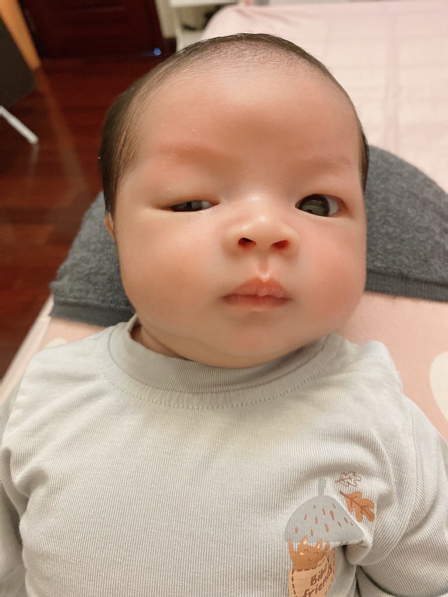 Chào các mẹ! Con mình 11 ngày rồi mà vẫn mở một bên to một bên nhỏ! Khi đến viện bác sĩ mắt nói mắt không vấn đề gì? Có người nói do chuyển dạ lâu nên mắt con chưa mở được ngay. Nhưng nay đã 11 ngay mà một bên mắt chỉ mở to hơn chút xíu! Có mẹ nào có trường hợp tương tự như này không ạ?