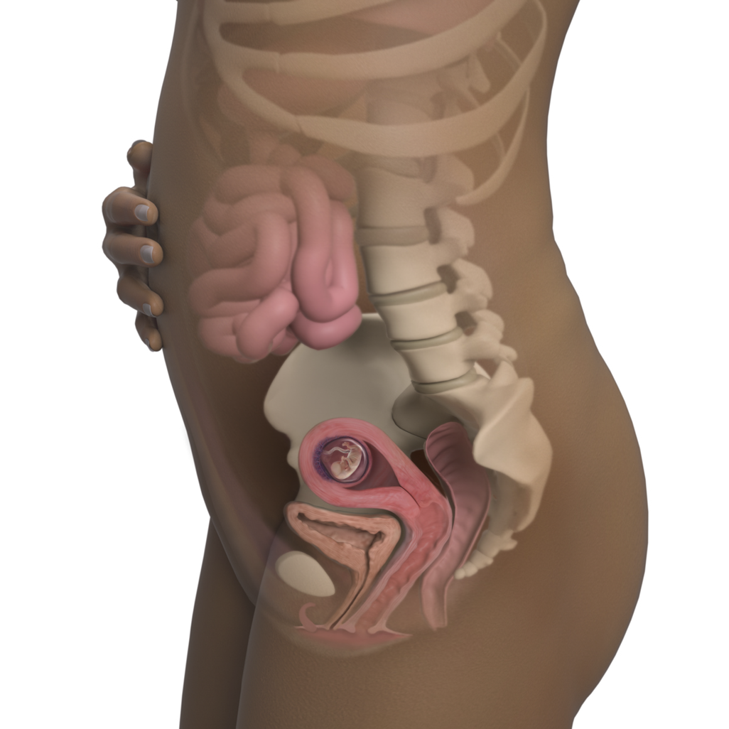 THAI 11 TUẦN: NHỮNG ĐIỀU CƠ BẢN MẸ CẦN BIẾT ĐỂ BÉ PHÁT TRIỂN TỐT NHẤT 

Dưới đây là những chia sẻ của anh Phạm Ngọc Thắng, nhà sáng lập ứng dụng thai giáo Mamibabi, và cũng là tác giả cuốn sách “Rủ chồng thai giáo” về sự phát triển của thai nhi 11 tuần. Hy vọng những thông tin này sẽ giúp mẹ thai giáo tốt nhất cho bé trong tuần này. 

💙 KHÁM THAI 11 TUẦN 
Điều đầu tiên mình muốn nhắn nhủ các mẹ trong tuần này là mẹ cần lên lịch khám thai, bởi giai đoạn 11 đến 13 tuần là thời điểm rất quan trọng để làm double test, đo độ mờ da gáy, từ đó chẩn đoán nguy cơ dị tật bẩm sinh ở trẻ. 

Thời điểm lý tưởng nhất để làm xét nghiệm này là tuần 11 cho tới tuần 13 của thai kỳ. Mẹ hãy ghi lại hoặc đặt lịch ngay với bác sĩ để không quên nhé! 

Mình đã nghe nhiều mẹ chia sẻ về việc rất hoang mang khi làm double test vì nếu không may kết quả cho thấy con có nguy cơ dị tật thì phải làm thế nào. Các mẹ đừng lo lắng quá nhé vì double test có độ chính xác chỉ 75%. Nếu có nguy cơ cao, bác sĩ sẽ yêu cầu mẹ làm thêm nhiều phương pháp sàng lọc và xét nghiệm chẩn đoán khác nữa. Thực tế là có những em bé khi xét nghiệm cho ra kết quả bé bị dị tật, bị down, nhưng khi sinh ra thì bé lại khỏe mạnh bình thường. 

💙 THAI 11 TUẦN KÍCH THƯỚC BAO NHIÊU? 
Theo chỉ số mới nhất từ WHO, với một em bé phát triển bình thường, ở tuần 11 này bé nặng khoảng 45g, dài 4,1cm; tương đương với 1 quả chanh vàng hoặc 1 quả quýt nhỏ. 

💙 THAI 11 TUẦN PHÁT TRIỂN NHƯ THẾ NÀO? 
Nếu nhìn ảnh siêu âm mẹ sẽ thấy phần đầu của bé vẫn rất to. So với tuần trước, mặt của bé đã rộng hơn và 2 mắt cũng tách xa nhau hơn. Phần tai phía trên của bé đã mọc lên nhiều, có độ cong rõ, tuy nhiên vẫn chưa thể giống như một chiếc tai hoàn chỉnh. 

💙 THAI 11 TUẦN BIẾT TRAI HAY GÁI CHƯA? 
Bộ phận sinh dục của bé vẫn đang phát triển nhưng qua ảnh siêu âm sẽ rất khó để xác định được chính xác bé là trai hay gái ở thời điểm này. 

💙 THAY ĐỔI CỦA MẸ BẦU TUẦN 11 
1 số mẹ sẽ thấy đỡ nghén hơn ở tuần này, và có thể hết nghén hẳn khi bước sang tuần thứ 12. Nhưng mỗi mẹ mỗi khác, có mẹ vẫn sẽ nghén nhiều như các tuần trước. 

Ngoài ra, mẹ có thể bị đầy bụng, tiểu tiện nhiều, phần ngực nhạy cảm và vùng da quanh rốn có thể tối màu hơn 

Da của mẹ ở thời điểm này có thể sẽ tiết nhiều dầu hơn bình thường, khiến da trông có vẻ căng mịn. Nhưng cùng với đó có thể là sự xuất hiện của mụn trứng cá. Vì vậy, mẹ hãy chú ý đến việc dưỡng da nhé! 

💙 THAI GIÁO TUẦN THỨ 11 
Dưỡng da là 1 trong những cách thai giáo tốt giúp mẹ cải thiện cả ngoại hình lẫn cảm xúc của mình. Ai mang bầu cũng muốn mình là một mẹ bầu xinh đẹp đúng không ạ? Dưỡng da trong giai đoạn này mẹ chú ý sử dụng các sản phẩm hoàn toàn tự nhiên nhé, đã được chứng nhận hữu cơ thì càng tốt. Có một sản phẩm mà vợ mình lúc nào cũng dùng, kể cả khi mang thai, đó là nước hoa hồng nguyên chất. Nước hoa hồng có thể dùng cho mọi loại da, và giúp cân bằng độ ẩm rất tốt cho da, nhất là sau khi rửa mặt. Các mẹ hãy chọn cho mình những sản phẩm từ tự nhiên kiểu như vậy nhé! 

Cách thai giáo thứ 2 mẹ nên làm trong tuần này là chơi game 2048: Chơi game là một trong những cách thai giáo có tác dụng “2 trong 1”, vừa giúp mẹ bầu và thai nhi thư giãn, vừa giúp cải thiện kỹ năng của mẹ cũng như trí thông minh của bé. Vào thời điểm thai nhi 11 tuần, mẹ có thể dành khoảng 5 phút mỗi ngày để chơi game 2048. Các mẹ Do Thái rất khuyến khích việc giải toán hoặc chơi game toán học trong thời gian mang thai để giúp thai nhi phát triển trí não tốt nhất. Mẹ có thể chơi game 2048 ngay trên ứng dụng Mamibabi nhé! 
 
💙 THAI 11 TUẦN NÊN ĂN GÌ? 
Ngoài ra, thai giáo dinh dưỡng cũng là điều mẹ cần quan tâm. Mẹ đừng quên bổ sung các thức ăn giàu sắt vào chế độ ăn mỗi ngày. Sắt tự nhiên có nhiều trong cải bó xôi, các loại đậu, thịt bò, hạt bí, súp lơ xanh, đậu phụ, củ cải, cá… Một số món đơn giản mẹ có thể nấu là súp lơ xào thịt bò, canh củ cải thịt viên, cháo đậu xanh thịt bằm… 

Ngoài ra, mẹ cũng có thể bổ sung viên uống chứa sắt, nhưng nhớ tham khảo ý kiến của bác sĩ trước khi sử dụng nhé. Uống viên sắt rất hay gây táo bón. Vì thế mẹ đừng quên 2 việc quan trọng: 1 là ăn nhiều rau củ quả, 2 là uống nhiều nước. Đối với nước, mẹ có thể uống nước lọc, nước ép trái cây, nước canh, hoặc ăn các món chứa nước như cháo, súp, bún, phở… Riêng với nước ép trái cây thì mẹ uống vừa thôi, đừng lạm dụng vì nước ép trái cây chứa nhiều đường, có thể làm tăng nguy cơ tiểu đường thai kỳ. 

💙 VẬN ĐỘNG TUẦN THỨ 11 
Để hạn chế nguy cơ tiểu đường và các bệnh về tim mạch, huyết áp, mẹ hãy đi bộ và vận động nhẹ nhàng mỗi ngày nhé! Nghỉ ngơi cũng là điều rất cần thiết trong giai đoạn này. Nếu có thể, mẹ hãy kéo dài thêm thời gian ngủ của mình, đặc biệt ngủ trưa là điều rất tốt để mẹ tái tạo năng lượng và hạn chế các triệu chứng ốm nghén khó chịu. 

Để biết rõ hơn về sự phát triển của thai nhi mỗi tuần và những cách thai giáo tốt nhất, mẹ hãy cài đặt ứng dụng Mamibabi ngay hôm nay nhé >>> https://mamibabi.com.vn/app 
#thaigiao #thai_giáo #thaigiáo #mangthai #babau