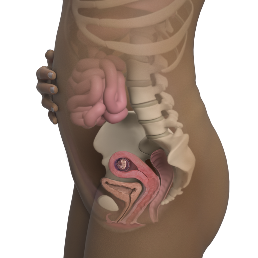 THAI 10 TUẦN TUỔI VÀ CÁCH THAI GIÁO TỐT NHẤT CHO BÉ 

💙 THAI 10 TUẦN PHÁT TRIỂN NHƯ THẾ NÀO?
 
Nếu nhìn hình ảnh siêu âm của bé ở tuần này, bố mẹ sẽ thấy bàn tay bé có 1 sự khác biệt lớn, đó là những ngón tay đã tách nhau riêng rẽ, không còn liên kết với nhau bởi một lớp màng giống như màng ở chân của những chú vịt nữa. Móng tay bé cũng bắt đầu được hình thành. 

Cả chân và tay của bé đều đã mọc dài hơn so với tuần trước. 

Đầu của bé vẫn khá to so với thân, phần trán nhô rõ lên, và não bộ vẫn đang phát triển tốt. 

Lông mi cũng phủ lên mắt của bé với nhiệm vụ bảo vệ mắt, nhưng dĩ nhiên qua hình ảnh siêu âm mẹ sẽ không nhìn thấy được rõ lông mi của bé. 

Các chồi răng của bé cũng bắt đầu xuất hiện phía dưới lợi. 

Tuần này, bé nặng khoảng 4g, dài 3 - 4cm, tương đương với một quả mận hoặc một quả quất to. 

💙 MANG THAI TUẦN THỨ 10 MẸ GẶP NHỮNG TRIỆU CHỨNG GÌ? 

Tuy bé có khá nhiều thay đổi, nhưng mẹ sẽ không khác lắm so với tuần trước. Hiện mẹ vẫn đang trong tháng thứ 3 của thai kỳ, hiện tượng ốm nghén có thể vẫn còn, chưa thể hết hẳn. Mẹ vẫn sẽ thấy các triệu chứng phổ biến như đau lưng, mệt mỏi, chán ăn, đầy bụng, sợ mùi… 

Chỉ cần qua 3 tháng đầu thôi, các triệu chứng ốm nghén sẽ giảm dần ở đa số mẹ bầu. 

Tuy nhiên, có một hiện tượng khá nhiều mẹ gặp phải ở giai đoạn này, đó là đau bụng âm ỉ. Đôi khi, hiện tượng đau bụng này có thể là do rối loạn tiêu hóa hoặc táo bón, như vậy không nguy hiểm, mẹ chỉ cần cải thiện việc ăn uống là được. Cũng có lúc đau bụng là do ảnh hưởng của đau lưng, khi mà các vùng cơ bị giãn nở, kéo căng và cũng không nguy hiểm.

Nhưng cũng có những trường hợp, đau bụng ở tuần thứ 10 liên quan tới việc sảy thai, nhất là khi mẹ bị ra máu. Vì vậy tốt nhất, khi có hiện tượng đau bụng âm ỉ không đỡ, mẹ nên tới gặp bác sĩ để được thăm khám kịp thời. 

💙 KHÁM THAI TUẦN THỨ 10 

Nói về việc khám thai, tuần thứ 10 không phải là mốc quan trọng hay bắt buộc mẹ phải đi khám. Sau 1 tuần nữa, tức là tuần thứ 11, đó sẽ là tuần quan trọng hơn. 

Tuy vậy, nếu đi khám thai ở tuần thứ 10, mẹ vẫn có thể khám các thông tin cơ bản như cân nặng của mẹ, cân nặng của bé, nghe tim thai, kiểm tra dị dạng chi… Và nếu đã đi khám mẹ hãy thoải mái hỏi bác sĩ về mọi vấn đề mẹ còn băn khoăn hay lo lắng nhé. 

Tốt nhất, trước khi đi khám, ngay từ lúc còn ở nhà, mẹ hãy liệt kê ra tất cả những điều mình muốn hỏi bác sĩ cho đỡ quên vì nói thật là mẹ bầu nhiều lúc cũng khá là hay quên đấy ạ. 

💙 THAI GIÁO TUẦN THỨ 10 

Sau khi đi khám, nếu bác sĩ nói rằng mẹ và bé đều khỏe mạnh, bình thường thì mẹ đừng quên thai giáo cho bé mỗi ngày nhé. 3 việc mẹ nên làm trong giai đoạn này là: 

1 là nghe truyện thai giáo: Đây là hình thức thai giáo ngôn ngữ rất tốt cho sự phát triển của thai nhi. Mỗi ngày, mẹ nên dành thời gian nghe một câu chuyện thật ý nghĩa hoặc truyện hài vui vẻ cũng được. Mẹ có thể cùng thai nhi nghe truyện, cũng có thể tự mình đọc truyện hoặc kể truyện cho thai nhi nghe.

2 là học ngoại ngữ: Đây là hình thức thai giáo tri thức rất được mẹ Do Thái coi trọng. Mẹ có thể học bất kỳ ngôn ngữ nào mình thích, miễn sao luôn cảm thấy vui vẻ và hào hứng, không bắt buộc phải học tiếng Anh. Việc học ngoại ngữ không chỉ giúp mẹ nâng cao kiến thức cho mình mà còn giúp thai nhi thông minh hơn ngay từ khi còn trong bụng mẹ.

3 là đọc sách: Đây cũng là hình thức thai giáo tri thức được mẹ Do Thái chú trọng. Dân tộc Do Thái được biết đến là dân tộc thông minh nhất thế giới ở nhiều lĩnh vực. Trong thời gian mang thai, mẹ Do Thái dành rất nhiều thời gian đọc sách để truyền đạt kiến thức tới thai nhi của mình. 

Tuần thứ 10 vẫn đang trong giai đoạn 3 tháng đầu tiên, cũng là 3 tháng nhạy cảm nhất cần cẩn thận để tránh sảy thai. Vì vậy mẹ hãy chú trọng các hình thức thai giáo nhẹ nhàng, hạn chế vận động nhiều để đảm bảo an toàn cho thai nhi nhé. 

💙 THAI 10 TUẦN NÊN ĂN GÌ? 

Bên cạnh việc thai giáo mỗi ngày, mẹ cũng cần chú trọng tới ăn uống. 
Trong mỗi bữa mẹ nên ăn đa dạng thực phẩm. Theo phương pháp ăn để sống lâu của người Nhật, mỗi ngày chúng ta nên ăn rau củ 5 màu. Màu sắc của rau củ chính là đại diện cho các chất. Ăn càng nhiều loại rau củ có màu sắc khác nhau, chúng ta sẽ càng hấp thu được đa dạng chất dinh dưỡng.

Có 1 loại rau được coi là super food, tức là “siêu thực phẩm”, đó là cải bó xôi, còn gọi là rau chân vịt. Ngày xưa nếu mẹ nào xem phim “Thuỷ thủ lực sĩ Popeye” hẳn sẽ biết anh chàng này thường xuyên ăn rau chân vịt để trở nên khoẻ mạnh. Trên thực tế, đúng là loại rau này rất nhiều dưỡng chất tốt cho sức khoẻ. 

Vì thế mà có những mẹ ăn cải bó xôi liên tục, hết luộc đến xào. Nhưng cho dù tốt đến mấy các mẹ cũng không nên ăn quá dày đặc, mà nên ăn cùng các loại rau củ khác nữa nhé. 

💙 THAI 10 TUẦN NÊN VẬN ĐỘNG NHƯ THẾ NÀO? 

Bên cạnh việc ăn uống, mẹ cũng cần chú ý vận động hợp lý. Trước khi tập bất cứ hình thức nào mẹ cũng nên đi khám thai và hỏi ý kiến bác sĩ. 

Thiền được coi là hình thức vận động “cả thân lẫn tâm" và rất an toàn trong thời gian này. Mẹ có thể thực hiện thiền mỗi ngày nhé! 
Mẹ cũng có thể bơi lội hoặc tập các bài tập nhẹ nhàng dưới nước. Điều quan trọng nhất là đảm bảo sự an toàn và thoải mái cho cả 2 mẹ con.