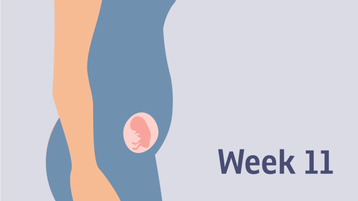 THAI 11 TUẦN: NHỮNG ĐIỀU CƠ BẢN MẸ CẦN BIẾT ĐỂ BÉ PHÁT TRIỂN TỐT NHẤT 

Dưới đây là những chia sẻ của anh Phạm Ngọc Thắng, nhà sáng lập ứng dụng thai giáo Mamibabi, và cũng là tác giả cuốn sách “Rủ chồng thai giáo” về sự phát triển của thai nhi 11 tuần. Hy vọng những thông tin này sẽ giúp mẹ thai giáo tốt nhất cho bé trong tuần này. 

💙 KHÁM THAI 11 TUẦN 
Điều đầu tiên mình muốn nhắn nhủ các mẹ trong tuần này là mẹ cần lên lịch khám thai, bởi giai đoạn 11 đến 13 tuần là thời điểm rất quan trọng để làm double test, đo độ mờ da gáy, từ đó chẩn đoán nguy cơ dị tật bẩm sinh ở trẻ. 

Thời điểm lý tưởng nhất để làm xét nghiệm này là tuần 11 cho tới tuần 13 của thai kỳ. Mẹ hãy ghi lại hoặc đặt lịch ngay với bác sĩ để không quên nhé! 

Mình đã nghe nhiều mẹ chia sẻ về việc rất hoang mang khi làm double test vì nếu không may kết quả cho thấy con có nguy cơ dị tật thì phải làm thế nào. Các mẹ đừng lo lắng quá nhé vì double test có độ chính xác chỉ 75%. Nếu có nguy cơ cao, bác sĩ sẽ yêu cầu mẹ làm thêm nhiều phương pháp sàng lọc và xét nghiệm chẩn đoán khác nữa. Thực tế là có những em bé khi xét nghiệm cho ra kết quả bé bị dị tật, bị down, nhưng khi sinh ra thì bé lại khỏe mạnh bình thường. 

💙 THAI 11 TUẦN KÍCH THƯỚC BAO NHIÊU? 
Theo chỉ số mới nhất từ WHO, với một em bé phát triển bình thường, ở tuần 11 này bé nặng khoảng 45g, dài 4,1cm; tương đương với 1 quả chanh vàng hoặc 1 quả quýt nhỏ. 

💙 THAI 11 TUẦN PHÁT TRIỂN NHƯ THẾ NÀO? 
Nếu nhìn ảnh siêu âm mẹ sẽ thấy phần đầu của bé vẫn rất to. So với tuần trước, mặt của bé đã rộng hơn và 2 mắt cũng tách xa nhau hơn. Phần tai phía trên của bé đã mọc lên nhiều, có độ cong rõ, tuy nhiên vẫn chưa thể giống như một chiếc tai hoàn chỉnh. 

💙 THAI 11 TUẦN BIẾT TRAI HAY GÁI CHƯA? 
Bộ phận sinh dục của bé vẫn đang phát triển nhưng qua ảnh siêu âm sẽ rất khó để xác định được chính xác bé là trai hay gái ở thời điểm này. 

💙 THAY ĐỔI CỦA MẸ BẦU TUẦN 11 
1 số mẹ sẽ thấy đỡ nghén hơn ở tuần này, và có thể hết nghén hẳn khi bước sang tuần thứ 12. Nhưng mỗi mẹ mỗi khác, có mẹ vẫn sẽ nghén nhiều như các tuần trước. 

Ngoài ra, mẹ có thể bị đầy bụng, tiểu tiện nhiều, phần ngực nhạy cảm và vùng da quanh rốn có thể tối màu hơn 

Da của mẹ ở thời điểm này có thể sẽ tiết nhiều dầu hơn bình thường, khiến da trông có vẻ căng mịn. Nhưng cùng với đó có thể là sự xuất hiện của mụn trứng cá. Vì vậy, mẹ hãy chú ý đến việc dưỡng da nhé! 

💙 THAI GIÁO TUẦN THỨ 11 
Dưỡng da là 1 trong những cách thai giáo tốt giúp mẹ cải thiện cả ngoại hình lẫn cảm xúc của mình. Ai mang bầu cũng muốn mình là một mẹ bầu xinh đẹp đúng không ạ? Dưỡng da trong giai đoạn này mẹ chú ý sử dụng các sản phẩm hoàn toàn tự nhiên nhé, đã được chứng nhận hữu cơ thì càng tốt. Có một sản phẩm mà vợ mình lúc nào cũng dùng, kể cả khi mang thai, đó là nước hoa hồng nguyên chất. Nước hoa hồng có thể dùng cho mọi loại da, và giúp cân bằng độ ẩm rất tốt cho da, nhất là sau khi rửa mặt. Các mẹ hãy chọn cho mình những sản phẩm từ tự nhiên kiểu như vậy nhé! 

Cách thai giáo thứ 2 mẹ nên làm trong tuần này là chơi game 2048: Chơi game là một trong những cách thai giáo có tác dụng “2 trong 1”, vừa giúp mẹ bầu và thai nhi thư giãn, vừa giúp cải thiện kỹ năng của mẹ cũng như trí thông minh của bé. Vào thời điểm thai nhi 11 tuần, mẹ có thể dành khoảng 5 phút mỗi ngày để chơi game 2048. Các mẹ Do Thái rất khuyến khích việc giải toán hoặc chơi game toán học trong thời gian mang thai để giúp thai nhi phát triển trí não tốt nhất. Mẹ có thể chơi game 2048 ngay trên ứng dụng Mamibabi nhé! 
 
💙 THAI 11 TUẦN NÊN ĂN GÌ? 
Ngoài ra, thai giáo dinh dưỡng cũng là điều mẹ cần quan tâm. Mẹ đừng quên bổ sung các thức ăn giàu sắt vào chế độ ăn mỗi ngày. Sắt tự nhiên có nhiều trong cải bó xôi, các loại đậu, thịt bò, hạt bí, súp lơ xanh, đậu phụ, củ cải, cá… Một số món đơn giản mẹ có thể nấu là súp lơ xào thịt bò, canh củ cải thịt viên, cháo đậu xanh thịt bằm… 

Ngoài ra, mẹ cũng có thể bổ sung viên uống chứa sắt, nhưng nhớ tham khảo ý kiến của bác sĩ trước khi sử dụng nhé. Uống viên sắt rất hay gây táo bón. Vì thế mẹ đừng quên 2 việc quan trọng: 1 là ăn nhiều rau củ quả, 2 là uống nhiều nước. Đối với nước, mẹ có thể uống nước lọc, nước ép trái cây, nước canh, hoặc ăn các món chứa nước như cháo, súp, bún, phở… Riêng với nước ép trái cây thì mẹ uống vừa thôi, đừng lạm dụng vì nước ép trái cây chứa nhiều đường, có thể làm tăng nguy cơ tiểu đường thai kỳ. 

💙 VẬN ĐỘNG TUẦN THỨ 11 
Để hạn chế nguy cơ tiểu đường và các bệnh về tim mạch, huyết áp, mẹ hãy đi bộ và vận động nhẹ nhàng mỗi ngày nhé! Nghỉ ngơi cũng là điều rất cần thiết trong giai đoạn này. Nếu có thể, mẹ hãy kéo dài thêm thời gian ngủ của mình, đặc biệt ngủ trưa là điều rất tốt để mẹ tái tạo năng lượng và hạn chế các triệu chứng ốm nghén khó chịu. 

Để biết rõ hơn về sự phát triển của thai nhi mỗi tuần và những cách thai giáo tốt nhất, mẹ hãy cài đặt ứng dụng Mamibabi ngay hôm nay nhé >>> https://mamibabi.com.vn/app 
#thaigiao #thai_giáo #thaigiáo #mangthai #babau