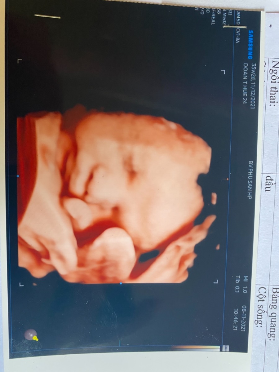 Chị em nào có kinh nghiệm đi đẻ ở Bệnh viện phụ sản Hải phòng cho em xin ít review với ạ. 
Em tập đầu sắp tới ngày sinh rồi mà hoang mang quá.