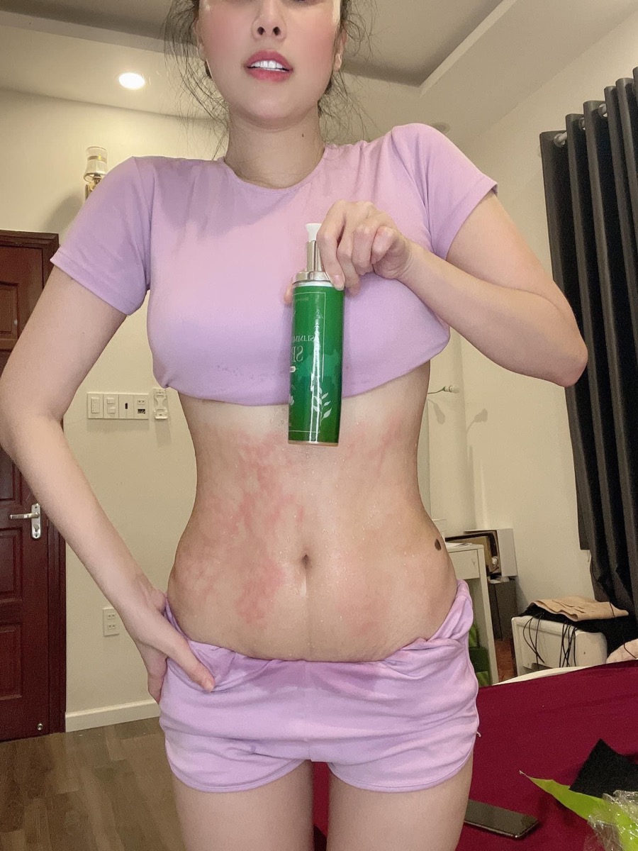 Có mom nào đau đầu vì quả bụng mỡ sau sinh không 🤣 Nói thật mới sinh đã stress rồi nhìn vào quả bụng chắc trầm cảm 🤣 các ce đừng quên chăm sóc bản thân sau sinh nhé ♥️