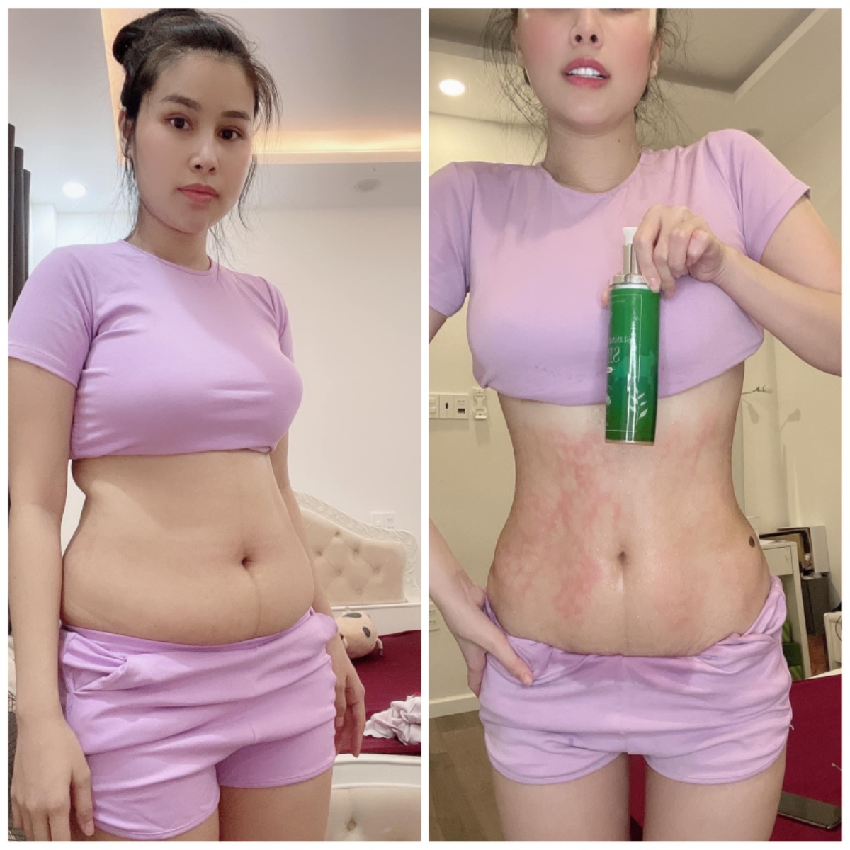 Có mom nào đau đầu vì quả bụng mỡ sau sinh không 🤣 Nói thật mới sinh đã stress rồi nhìn vào quả bụng chắc trầm cảm 🤣 các ce đừng quên chăm sóc bản thân sau sinh nhé ♥️