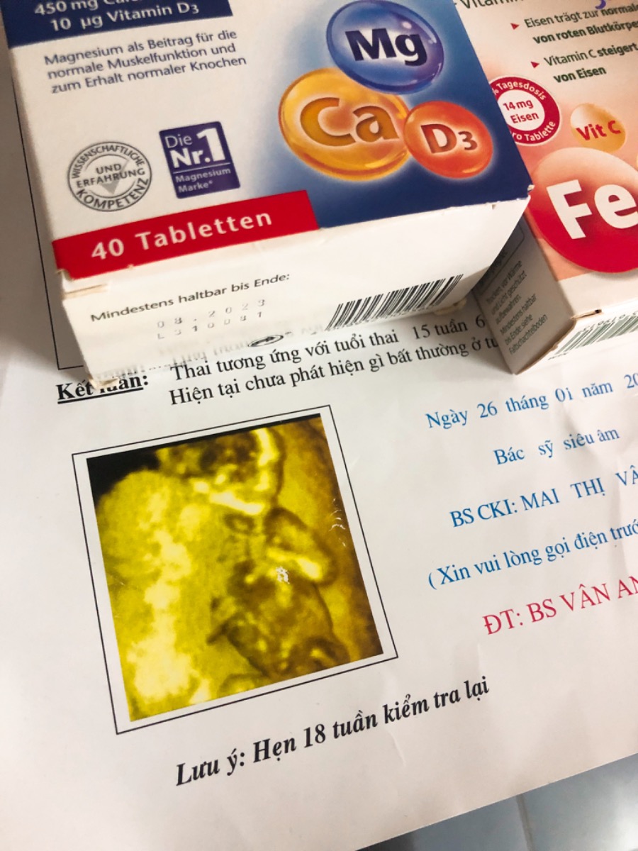 Mình mang thai lần đầu , mình đc 18t3 ngày đi sam bs bảo e bé khoẻ , bs bảo con e ng rất là dài so vs các bé khác ,,, liệu như bs nói con dài có a/ hưởng j ko ạ