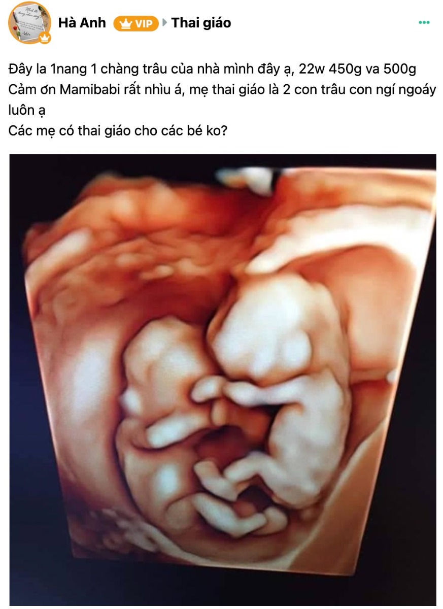 CHƯA HIỂU RÕ VỀ THAI GIÁO?

Khi mình tư vấn, đa số các mẹ đều bảo đã từng nghe về thai giáo, nhưng chưa hiểu rõ và chưa biết nó có những tác dụng gì, ko biết phải làm gì. NHƯNG... (lại nhưng) rất ngại tìm hiểu dù nó rất tốt cho con mình, nhưng vẫn ko dành thời gian xem mọi người thai giáo như thế nào mà đa số là đọc lướt lướt rồi bỏ qua.

Nguyên nhân chủ yếu là đa số các mẹ chỉ đọc 1 vài bài trên mạng, rồi nghe theo mọi người bảo làm 1 số hoạt động như nghe nhạc, nghe truyện... nên đa số đều hiểu rất nông về thai giáo. Hơn nữa thực hành thai giáo ko có lộ trình, ko đều đặn khiến việc thai giáo càng trở nên mất thời gian mà ko có tác dụng.

Mamibabi đã trải qua việc này 4 năm nay, với khoảng 150k mẹ thai giáo đều đặn mỗi ngày trên app. Chúng mình tự hào là nơi dễ dàng nhất để bắt đầu thai giáo.

Nhưng Mamibabi ko thể giúp được nếu các mẹ ko chịu tìm hiểu và ko chịu thai giáo cho con (nghĩa là vẫn có những thứ khác ưu tiên hơn, ko dành đc thời gian cho em bé trong bụng dù chỉ 10 - 15 phút/ngày).

1. Thai giáo đơn giản là các hoạt động giúp thai phát triển tốt, bên mình đã cố gắng trình bày thông tin rất ngắn gọn, đơn giản để mẹ có thể nắm bắt được ngay. Các mẹ chỉ cần vào đây đọc rất nhanh là có thể hiểu cơ bản, kèm theo những lợi ích, cách bắt đầu: https://mamibabi.com.vn/thai-giao

Nếu có thời gian mẹ có thể xem thêm video bài giảng mình giới thiệu từng hình thức, từng giai đoạn: https://mamibabi.com.vn/thaigiao/lythuyet

2. Bắt đầu thai giáo như thế nào: Mamibabi đã thiết kế sẵn các hoạt động theo từng ngày mang thai, đảm bảo đúng lộ trình thai giáo an toàn và hiệu quả, mỗi ngày từ 10-15 hoạt động, mẹ chỉ cần làm theo mục THAI GIÁO HÔM NAY là được.

3. Nếu bận quá hoặc muốn làm thêm các hoạt động nào, mẹ có thể chọn và làm trong thư viện trên app với gần 5k hoạt động, cực kỳ phong phú, đa dạng.

4. Mẹ nào yêu sách, thích đọc sách giấy thì có thể đặt mua sách "Rủ chồng thai giáo" mình viết, giá ưu đãi trên TIKI: https://shorten.asia/xeffzV1Y

TẤT CẢ chỉ có vậy thôi các mẹ ạ. Mình ko nghĩ là thai giáo lại tốn nhiều thời gian của các mẹ. Chủ yếu là do ngại tìm hiểu và ko dành được thời gian cho bé thôi á, còn Mamibabi chắc chắn là chỗ tốt nhất, dễ nhất để các mẹ thai giáo mỗi ngày rồi.

Mình muốn gửi lời cảm ơn sâu sắc đến các mẹ đã tin tưởng Mamibabi nhé, các bài tiếp theo mình sẽ chia sẻ tiếp rằng Mamibabi không chỉ có thai giáo mà còn là 1 app toàn diện về mang thai, nuôi con tới khi 6 tuổi!

Có gì chưa hiểu rõ, các mẹ có thể chat thêm với mình qua Zalo nhé: 0908 303 699.

Thang Pham
CEO Mamibabi