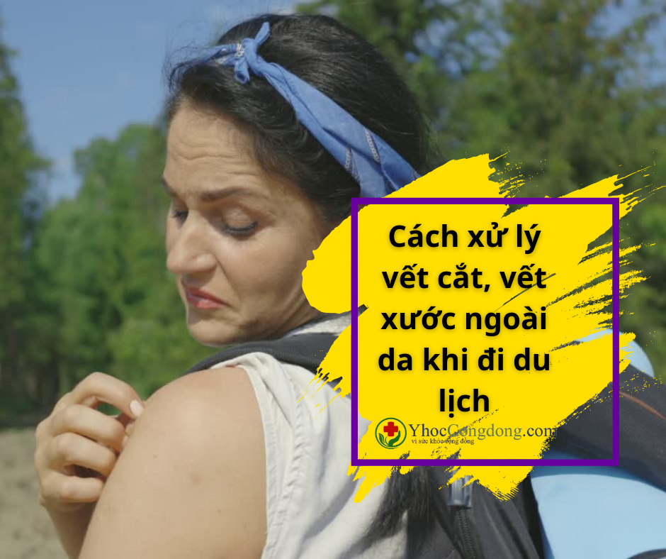 🧐 Trong quá trình đi du lịch có rất nhiều nguyên nhân khiến chúng ta bị các vết cắt, vết xước ngoài da. Vậy các dụng cụ y tế cần mang là gì và cách xử lý các tình huống này như thế nào?

1.Nhíp, dụng cụ không thể thiếu khi đi du lịch
👉 Nhíp là một phần thiết yếu của bất kỳ bộ sơ cứu nào. Cách an toàn nhất để loại bỏ dằm hoặc bọ ve là dùng một chiếc nhíp sạch. Khử trùng nhíp bằng cồn trước và sau mỗi lần sử dụng.

2. Kem hydrocortisone
👉 Đối với những vết cắn ngứa, hãy cân nhắc mang theo một tuýp nhỏ kem hydrocortisone 1%. Thuốc bôi steroid này sẽ giúp giảm ngứa và giảm viêm nhanh chóng.

3. Nước rửa tay và găng tay
👉 Nếu bạn hoặc người thân bị thương khi đang di chuyển, cần băng bó vết thương. Gel hoặc khăn lau có chứa cồn có thể khử trùng tay khi không có sẵn xà phòng và nước. Vệ sinh tay trước, đeo găng tay và vệ sinh lại sau khi xử lý vết thương.

4. Thuốc giảm đau
👉 Không có bộ sơ cứu nào hoàn chỉnh nếu không có thuốc giảm đau và hạ sốt. Aspirin, acetaminophen và ibuprofen là những loại thuốc giảm đau không kê đơn phổ biến. Aspirin không nên cho bất kỳ ai dưới 18 tuổi vì nguy cơ hội chứng Reye.

5. Gạc và băng
👉 Đối với vết cắt và vết xước, bạn có thể sử dụng miếng gạc để áp lên vết thương nhỏ cho đến khi máu giảm bớt. Băng, gạc cũng có thể dùng như một loại băng để che và bảo vệ vết thương. Băng dính với các kích cỡ khác nhau cũng có thể giúp bảo vệ các vết cắt và vết xước nhỏ.

6. Khăn lau hoặc dung dịch làm sạch vết thương
👉 Trước khi băng bó, bạn cần làm sạch vết xước hoặc vết thương. Khăn lau hoặc bình xịt khử trùng rất tiện dụng để lau vết thương khi không có nước sạch gần đó.

Nước hoặc nước muối vô trùng, rất tốt để rửa vết thương ở mắt và có thể được sử dụng trên các vết thương khác. Loại nước này có sẵn trong chai nhỏ, nó cũng có thể dễ dàng đóng gói.

7. Kem kháng sinh
👉 Kem hoặc thuốc mỡ kháng sinh có thể giúp bảo vệ vết thương nhỏ khỏi nhiễm trùng; thúc đẩy quá trình chữa lành; giúp vết thương không bị dính vào băng.

8. Thuốc trị dị ứng
👉 Thuốc kháng histamin chống dị ứng có thể giúp chống lại phản ứng dị ứng nhẹ. Những người bị dị ứng nghiêm trọng nên mang theo epinephrine dạng tiêm. Nó có thể cấp cứu trong trường hợp sốc phản vệ - một phản ứng dị ứng nghiêm trọng và có khả năng gây tử vong đối với các tác nhân gây ra như côn trùng đốt hoặc thức ăn.