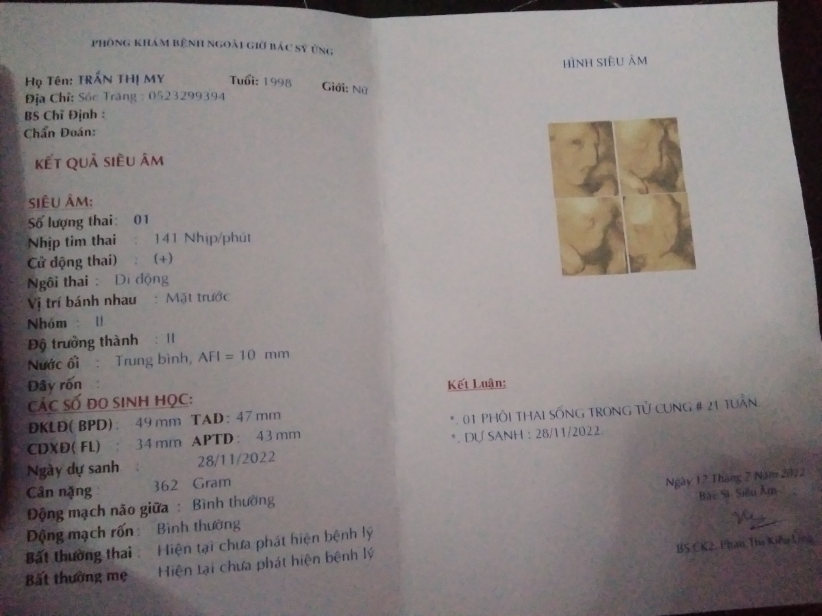 Bs cho e hoi ket qua vay co on hk ak vi em moi bi te va dong thai vs nuoc ôi it va be lai nho de lm sao cai thien tot cho me vs be ak