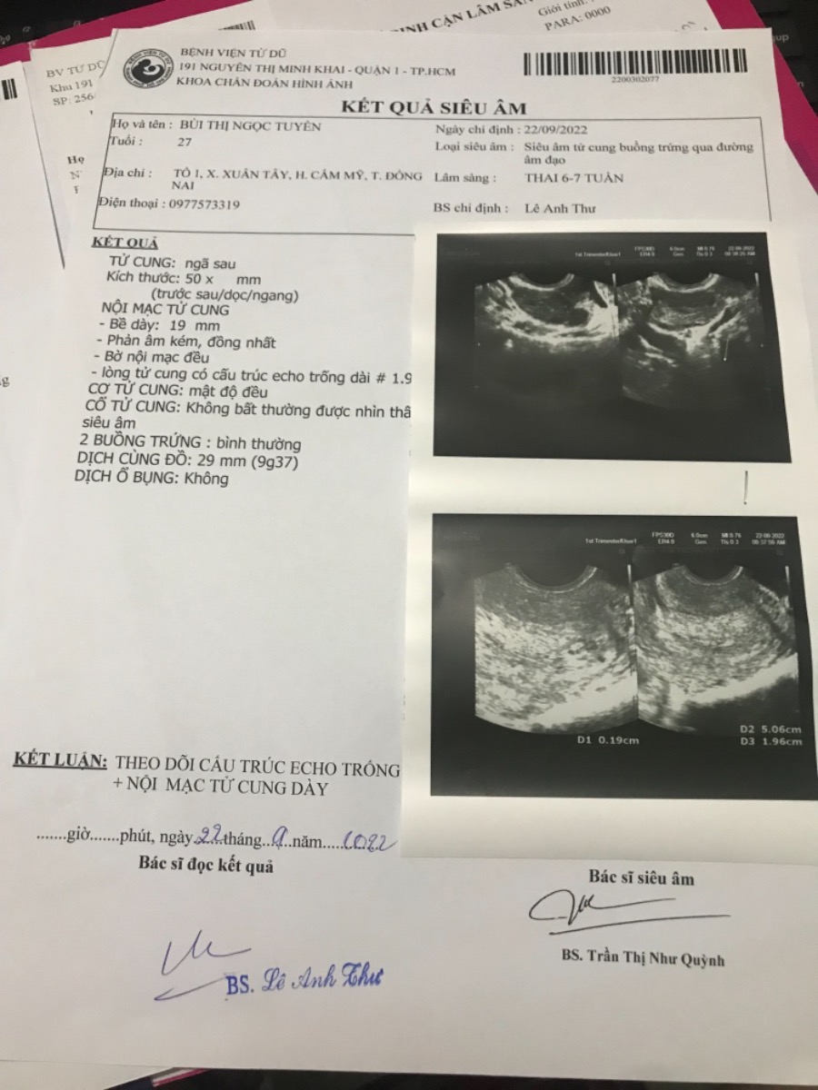 Ngày đầu chu kì cuối của e là ngày 29/7/2022. Ngày 22/9 e đi siêu âm thì kết quả như vầy. Cho e hỏi là thai của e bao nhiêu tuần rồi và khi nào thì thai vào tử cung ạ?