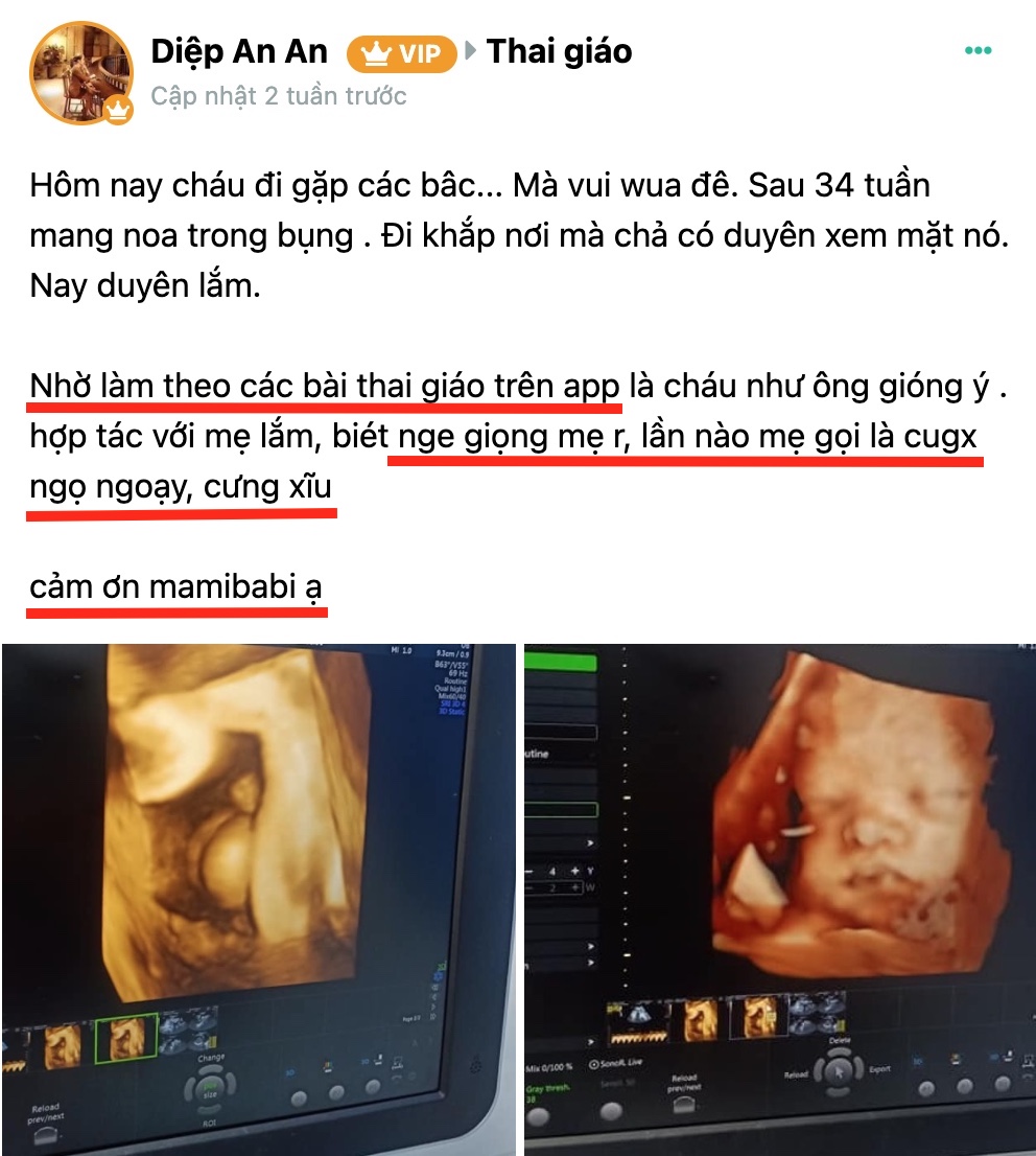 REVIEW TỪ NHỮNG MẸ VÀ BÉ ĐÃ VÀ ĐANG ĐỒNG HÀNH CÙNG MAMIBABI

Đây chỉ là một số trong hàng ngàn “người thật việc thật” đang đồng hành cùng Mamibabi. Đó đều là các mẹ đang mang thai và mới sinh, đang nuôi con nhỏ. Rất nhiều mẹ đã gửi những bức hình xinh xắn của con mình tới để “nhả vía” mẹ tròn con vuông cho các mẹ khác.

Mamibabi vô cùng hạnh phúc khi có thể tạo nên một cộng đồng mang nhiều năng lượng tích cực tới cho các mẹ và các bé. Internet là ảo những mỗi người mẹ, mỗi em bé, mỗi tình yêu đều là thật và vô cùng quý giá.

Mamibabi vẫn đang nỗ lực phát triển từng ngày. Nếu mẹ đã hài lòng hay chưa hài lòng về điều gì, hãy lên tiếng để Mamibabi cải thiện nhé. Mọi sự đóng góp của mẹ không chỉ có ích với Mamibabi mà còn có ích với rất nhiều bà mẹ và em bé khác đang sử dụng Mamibabi mỗi ngày!
________________________________
Mamibabi là ứng dụng thai giáo và giáo dục sớm duy nhất tại Việt Nam được xây dựng theo hướng “1 tài khoản – ngàn nội dung”, bạn chỉ cần mua tài khoản VIP Mom 1 lần duy nhất để đọc hàng ngàn nội dung về nuôi dạy con. 

- Hơn 3000 hoạt động thai giáo giúp mẹ vui bé khỏe https://mamibabi.com.vn/vip/info?mode=1
- Hơn 1000 bản nhạc thai giáo và karaoke thai giáo
- Hơn 1000 bài thơ và câu truyện thai giáo tiếng Anh, tiếng Việt, Ehon, audio
- Hơn 500 hoạt động giáo dục sớm cho bé từ 0 - 6 tuổi
- Hơn 300 món ăn dặm cho bé từ 6 tháng đến 2 tuổi  
- Thực đơn 280 ngày mang thai cho mẹ bầu  
- 43 khóa học toàn diện và chuyên sâu dành cho mẹ bầu và bé 0 - 6 tuổi: https://mamibabi.com.vn/khoa-hoc