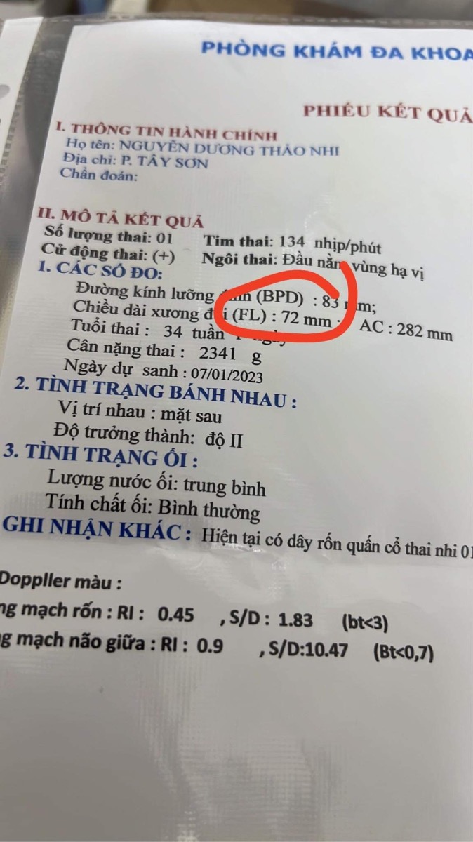 Hi cac mom , FL bé 72mm 34w có phải chân bé dài k ạ?