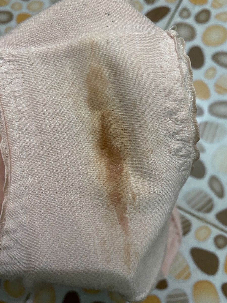 cho e hòi đây có phải máu báo thai không ạ. hay là bị viêm nhiễm, báo ngày rụng trứng ạ