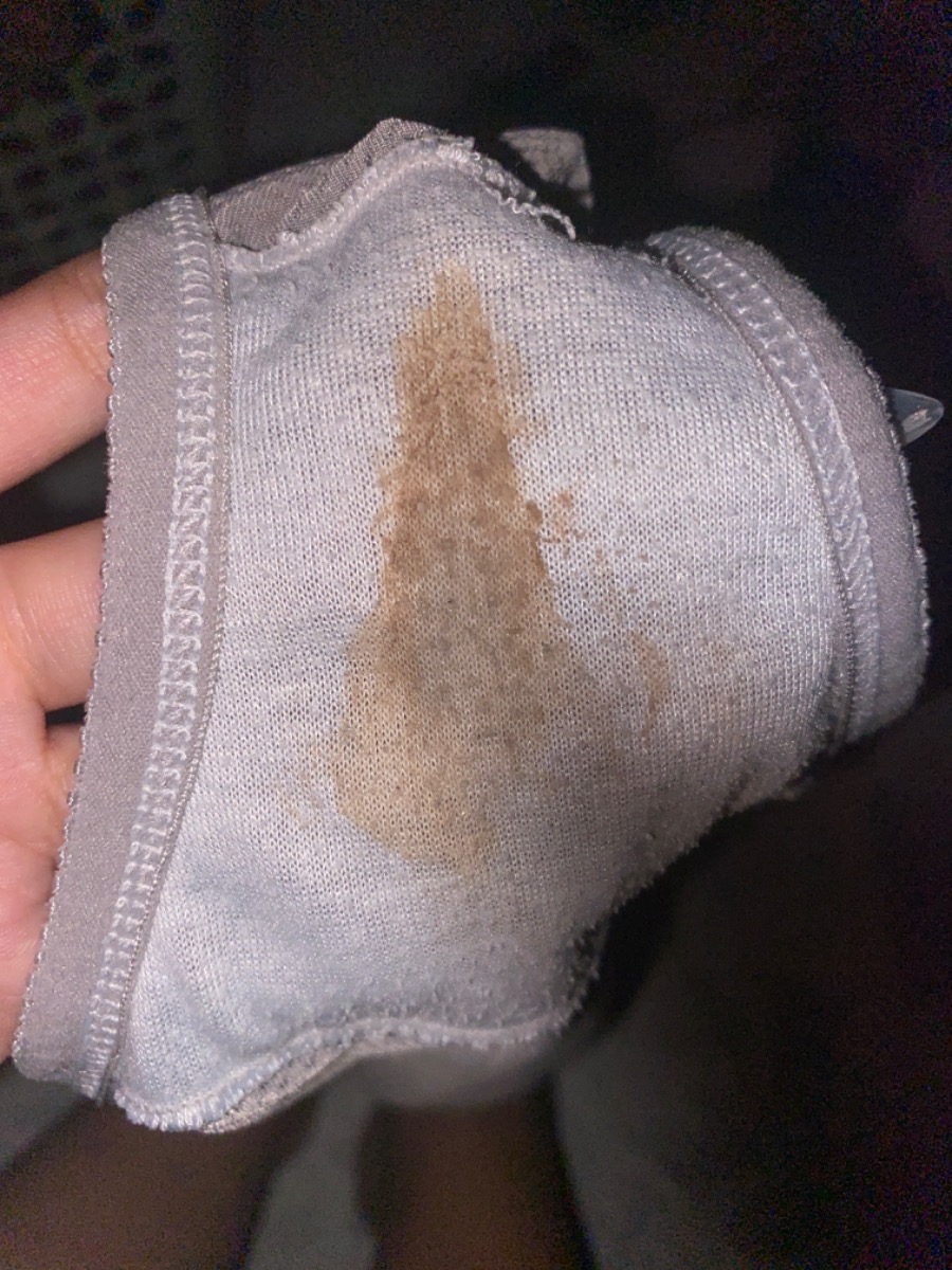 dạ cho em hỏi này có phải là máu báo thai ko ạ, em đi chơi về e thấy nó như này ạ mà 14 ngày nữa e mới tới chu kỳ ạ