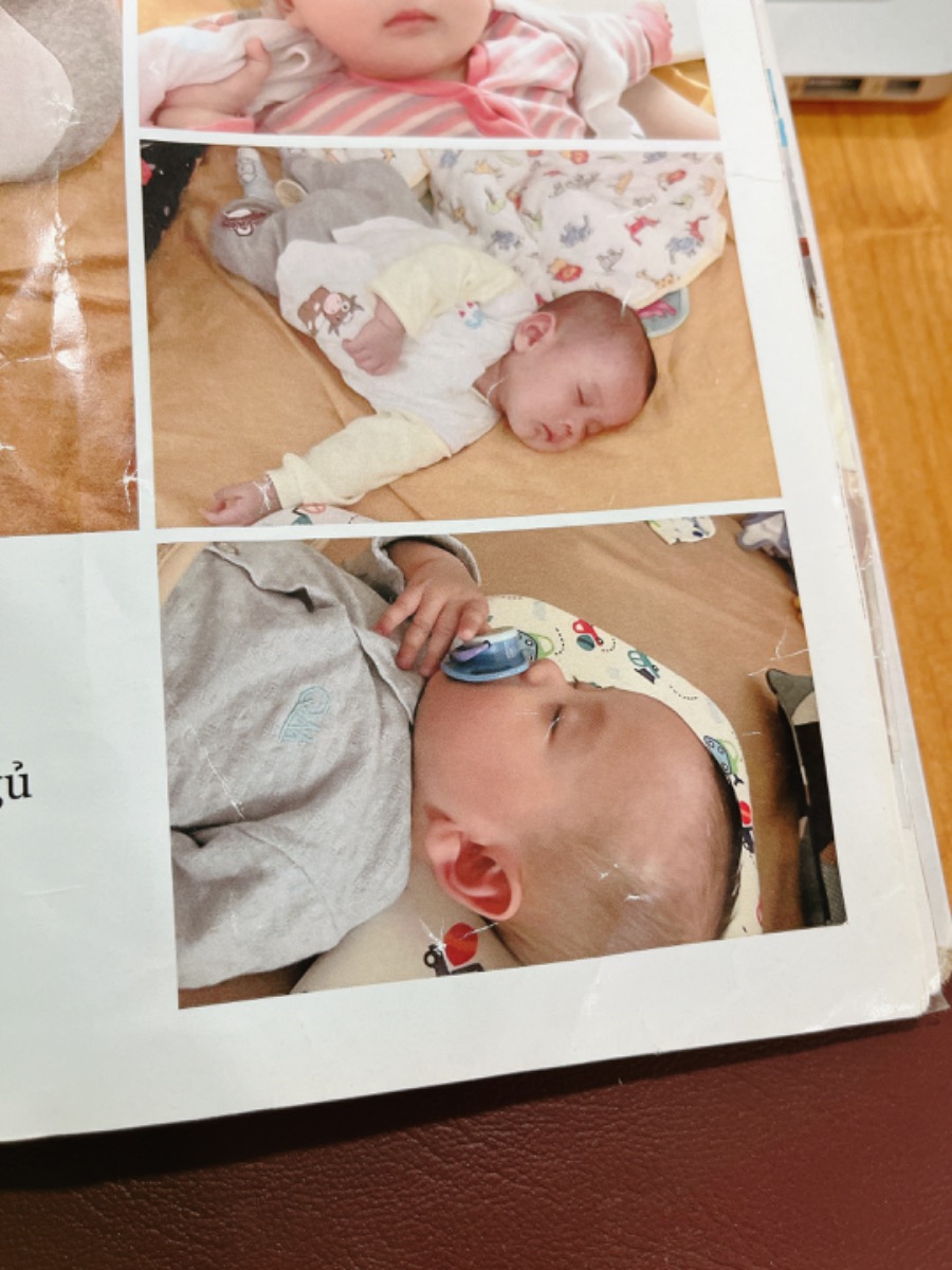 TI GIẢ: DÙNG SAO CHO ĐÚNG ĐỂ BÉ NGỦ NGON, KHÔNG BỊ NGHIỆN
 
Ti giả luôn là một trong những chủ đề gây nhiều tranh cãi trong suốt những năm qua. Bản thân bên mình khi tư vấn cũng thỉnh thoảng gặp các mẹ nói rằng em không muốn cho con dùng ti giả. Mình rất hiểu và tôn trọng điều đó. Tuy nhiên mình cũng xin phép được chia sẻ chút kinh nghiệm thực tế của mình để các mẹ tham khảo nhé.
 
Thứ 1, theo khoa học, ti giả giúp hạn chế hội chứng đột tử ở trẻ sơ sinh SIDS, vì vậy với các mẹ có con dưới 1 tuổi, mình vẫn khuyên là mẹ nên dùng (còn quyết định dùng hay không dĩ nhiên là ở mẹ).
 
Thứ 2, theo EASY, ti giả giúp con chuyển giấc tốt hơn, nhờ đó mà bé ngủ được dài hơn, mẹ nào theo EASY sẽ hiểu rõ hiều này.
 
Đó là về mặt lý thuyết. Còn về mặt kinh nghiệm thực tế của mình:
 
1. Không bao giờ cho con dùng ti giả khi con thức chơi. Nếu con thức, các mẹ hãy để con thoải mái ê a giao tiếp với mình. Nếu con có quấy khóc, không sao cả, khóc là đặc quyền của trẻ con mà. Mình có thể dỗ con bằng đồ chơi, bằng trò chơi, bằng cách ú òa để con dần quên. Nhưng tuyệt đối không cho con ngậm ti giả khi thức vì như vậy làm con không thể bật ra âm, lâu ngày làm con chậm nói, nói kém.
 
2. Chỉ dùng ti giả khi con ngủ, cụ thể là khi con chuyển giấc hoặc giật mình giữa chừng, chứ KHÔNG cho ti giả vào mồm con ngay từ đầu. Các mẹ hãy luyện cho con tự ngủ, chỉ cần ăn no, bỉm sạch, quấn chũn, phòng tối, yên tĩnh, mát, có tiếng ồn trắng… thì con “ngắm trần nhà” một chút rồi tự ngủ được luôn thôi. Trong quá trình con ngủ, khi con không tự chuyển giấc được và tỉnh dậy thì mình mới dùng ti giả trợ giúp con. Con ngủ say rồi, ti giả tự rơi ra thì kệ con chứ không “nhét” trở lại vào mồm con nữa.
 
3. Cai ti giả: Bé Heo nhà mình mất 2 tuần để “cai” ti giả, tức là khi con ngủ mà tỉnh giấc, ọ ẹ, thì mình vỗ vỗ nhẹ vào mông con để trấn an, con sẽ ngủ trở lại. Sau 2 tuần đó thì con hoàn toàn tạm biệt ti giả, và dĩ nhiên không có việc con bị “nghiện” ti giả. Đa số những trường hợp con “nghiện” ti giả khó cai đều là do bố mẹ đã để con dùng ti quá nhiều, có những nhà cho con ngậm ti giả cả tiếng đồng hồ khi con thức chơi đồ chơi và đi dạo. Không nên như vậy đâu bố mẹ ạ. Mình dùng đúng cách thì khỏe mẹ khỏe con và không sợ con “nghiện”.
 
Đó là một số chia sẻ của cá nhân mình. Mẹ có thể xem thêm cách dùng ti giả ở khóa học này nhé https://mamibabi.com.vn/interact/luyentigia
 
Đây chỉ là 1 trong 56 khóa học của bên mình, mẹ nào đã có tài khoản VIP Mom thì sẽ xem được cả 56 khóa. Những khóa mới trong thời gian sắp tới mẹ cũng sẽ xem được luôn. Ngoài 56 khóa mẹ còn xem được rất nhiều nội dung dưới đây về mang thai và sinh con:
 
- Được tư vấn mọi vấn đề về mang thai – thai giáo – nuôi con https://mamibabi.com.vn/community
- Lộ trình tăng cân 40 tuần của mẹ https://mamibabi.com.vn/special/pregnancy_weight_gain
- Bảng cân nặng thai nhi 40 tuần https://mamibabi.com.vn/news/95/can-nang-va-chieu-dai-thai-nhi-theo-chuan-who-2022
- Hơn 3000 hoạt động thai giáo giúp mẹ vui bé khỏe https://mamibabi.com.vn/vip/info?mode=1
- Hơn 1000 bản nhạc thai giáo và karaoke thai giáo https://mamibabi.com.vn/nhac-thai-giao 
- Hơn 1000 bài thơ và câu truyện thai giáo tiếng Anh, tiếng Việt, Ehon, audio https://mamibabi.com.vn/newscategory/15/truyen-thai-giao#fetalMenuPopup 
- Hơn 500 hoạt động giáo dục sớm cho bé từ 0 - 6 tuổi https://mamibabi.com.vn/khoa-hoc#gds 
- Hơn 300 món ăn dặm cho bé từ 6 tháng đến 2 tuổi https://mamibabi.com.vn/an-dam
- Thực đơn 280 ngày mang thai cho mẹ bầu https://mamibabi.com.vn/thai-giao-dinh-duong
- Những bài viết mới liên tục được tổng hợp và cập nhật https://mamibabi.com.vn/knowledge