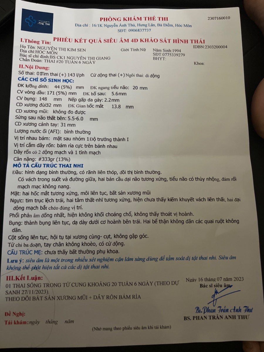 Nay e đi siêu âm 4d bs bảo bé k có xương mũi . E lo quá mai mới đi xn được mà e hồi hộp quá ạ