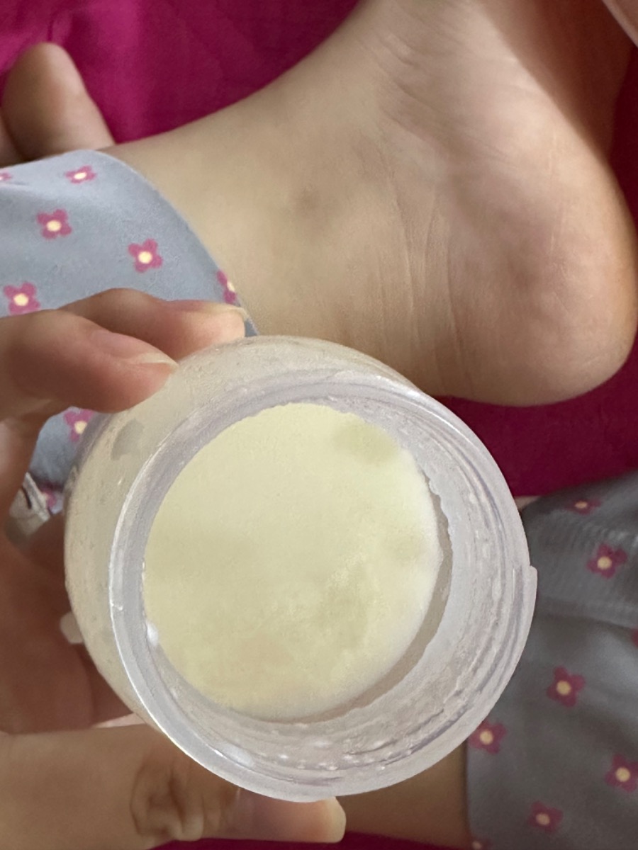 Cho e hỏi là em hút sữa ra thì có cái trắng trắng lợn cợn này thì có sao không ạ và đó là gì v ạ