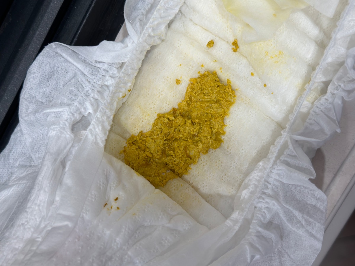 Bé nhà e 2,5m ti mẹ và dặm sữa ct thì phân ntn có vde gì