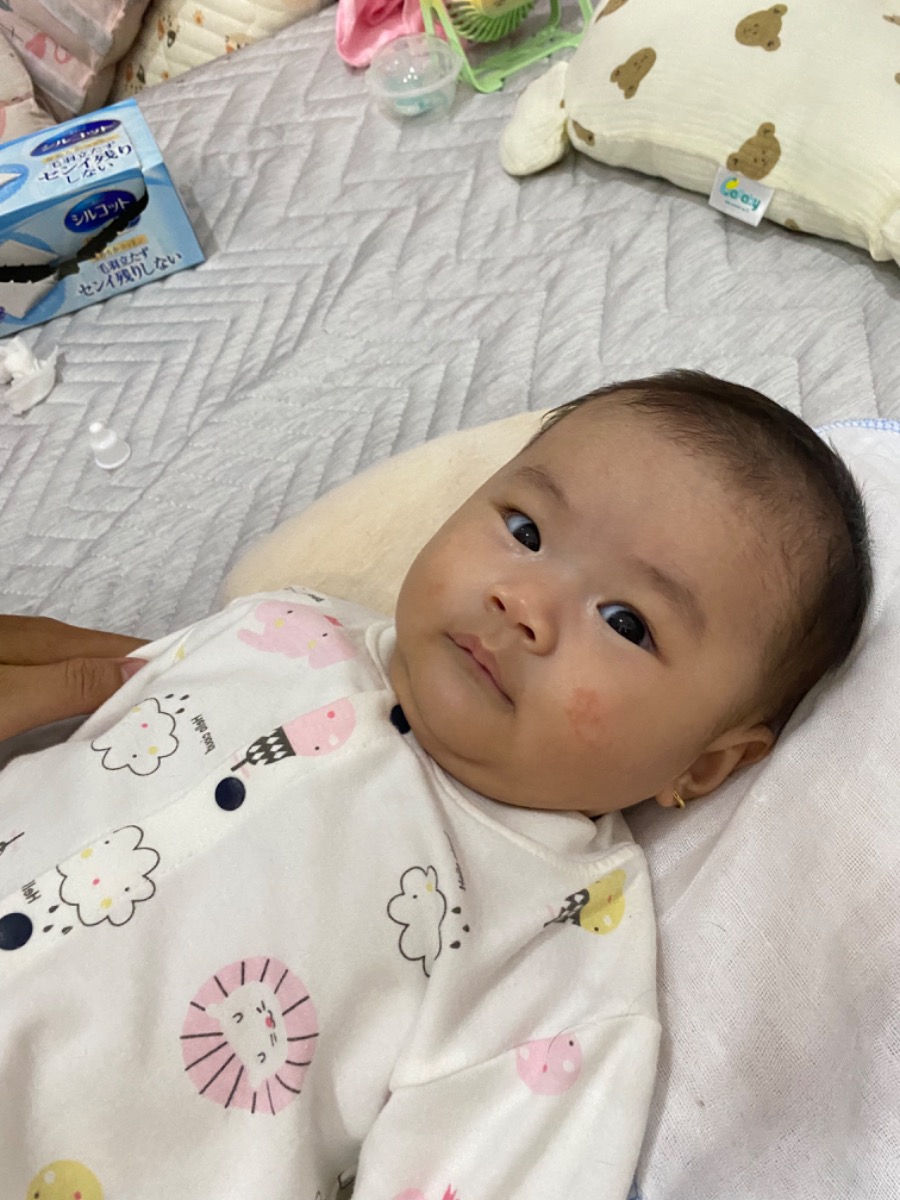 Mấy ngày trước mình có up bài hỏi chàm sữa mà thấy lâu quá không thấy trả lời mình tưởng hệ thống lỗi k nhận được câu hỏi của mình, bs và các mom cho mình hỏi bé bị chàm đã sd aveeno nhưng khi gần hết lại nổi lại v thì nên làm gì ạ và có cần bôi tiếp kem dưỡng hay ngưng v ạ mình cám ơn ạ