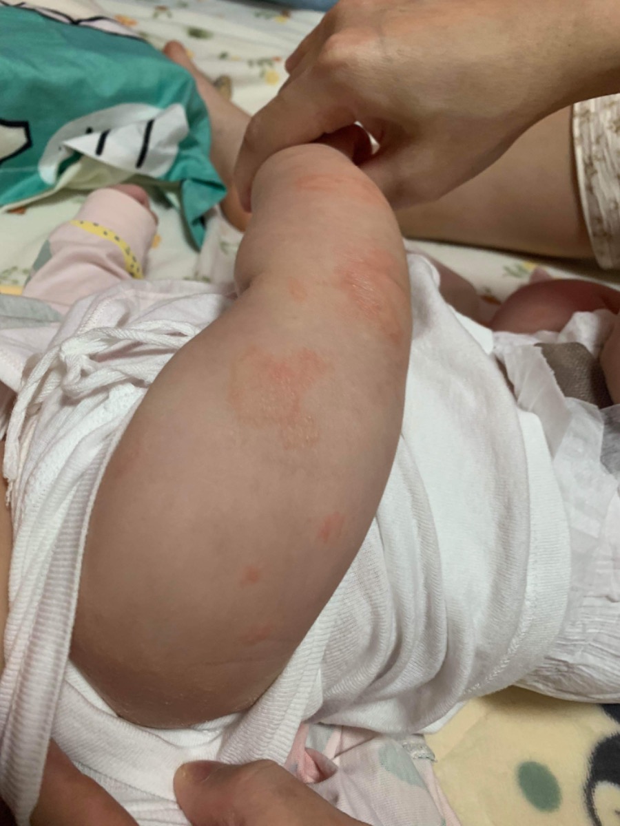 Admin cho e hỏi bé nhà e giwof nổi ntnay là bị khô da hay sao vậy ạ
Vẫn dưỡng ẩm thường xuyên ạ