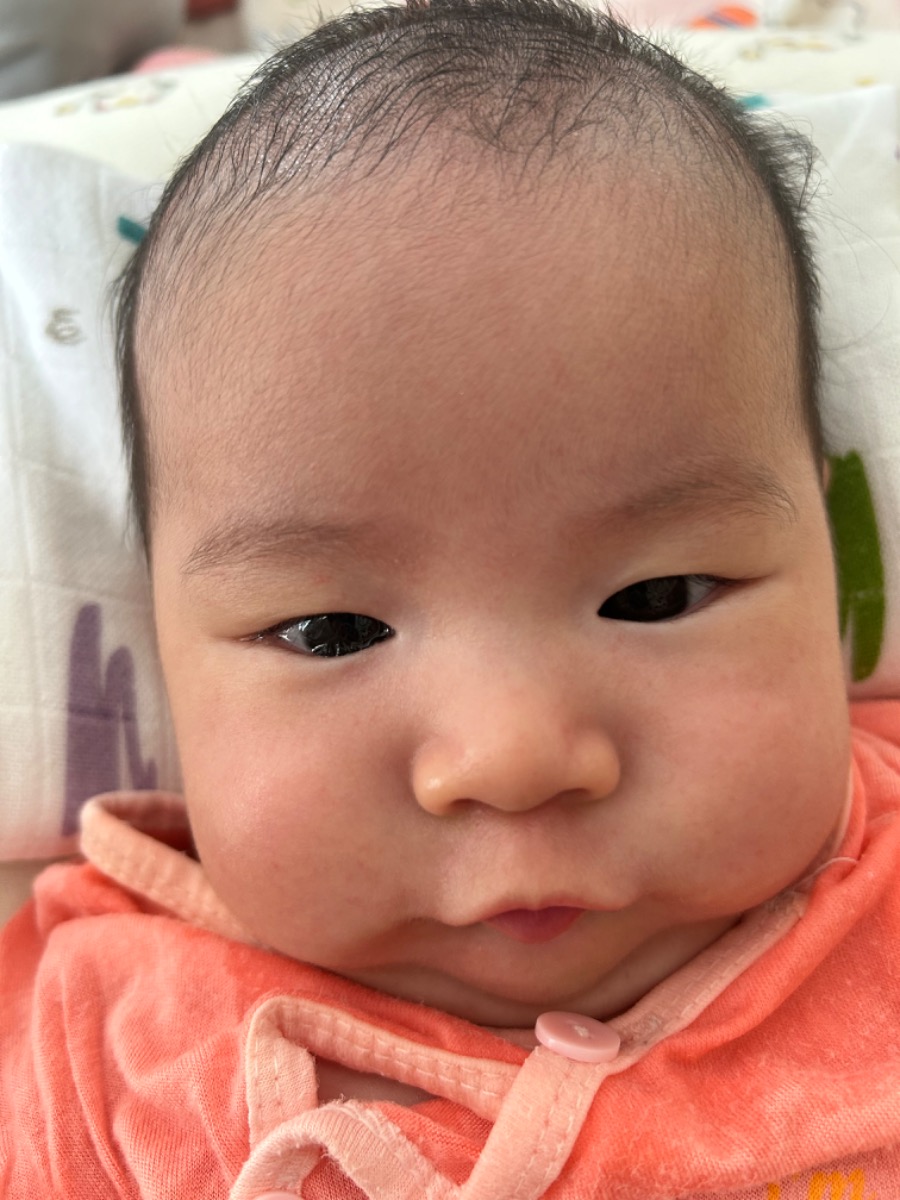 Chào chuyên gia. Con em bị nhặm mắt đổ ghèn nhưng chưa đỏ. Dùng nước muối sinh lý nhỏ hay cần sử dụng thuốc ạ. Em cảm ơn