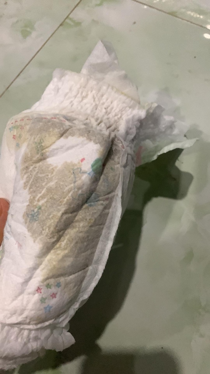 Bác sỹ ơi cho em hỏi, bé em hai tháng, đi ngoài 2-3 lần/ngày. Bốn ngày gần đây bé đj ngoài nhiều nước như ảnh, không có hạt. Bé bú và chơi bình thường. Bác cho e hỏi bé có phải tiêu chảy không ạ?