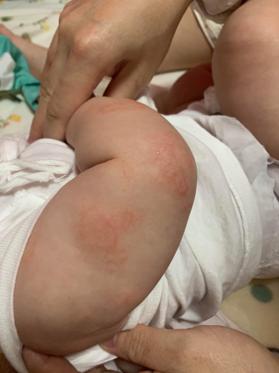 Admin cho e hỏi bé nhà e giwof nổi ntnay là bị khô da hay sao vậy ạ
Vẫn dưỡng ẩm thường xuyên ạ