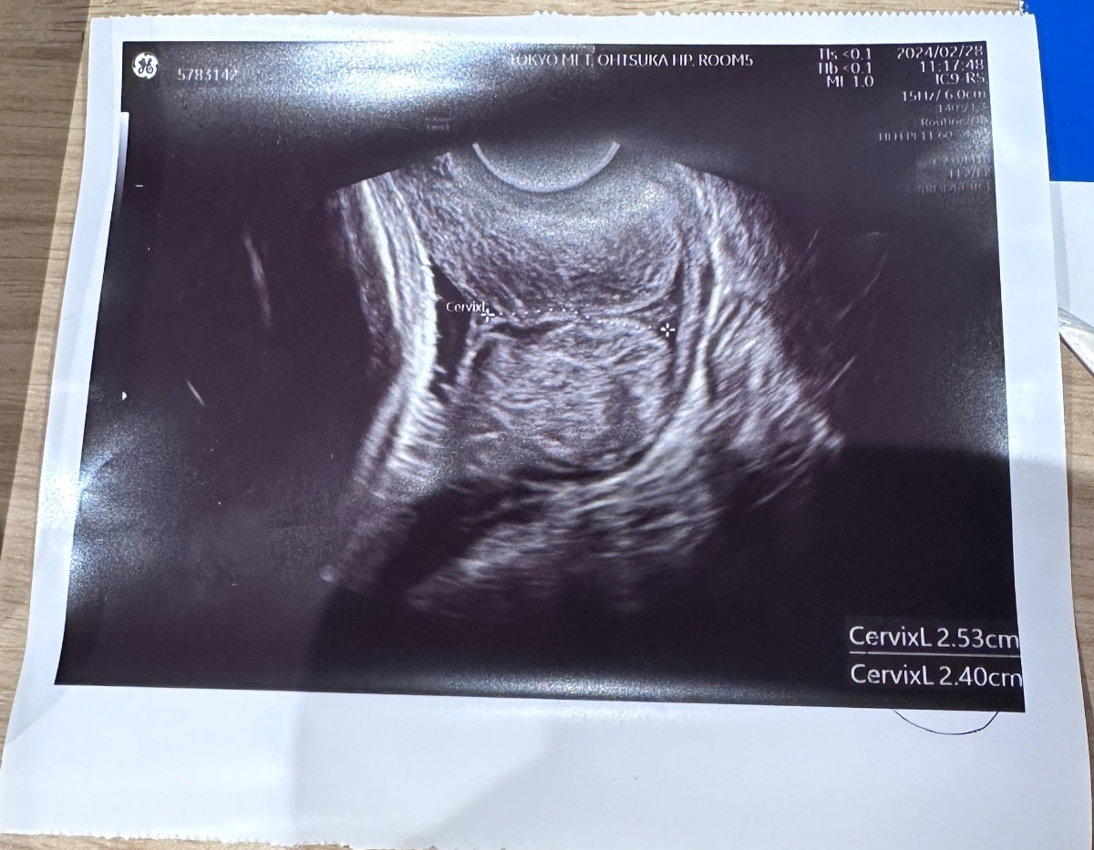 Chào add. Hiện tại m đang ở tuần thứ 29w6d, thì khi đi khám bác sỹ đo cổ tử cung là 2.53cm, và được cho là bị ngắn. Mình muốn hỏi là trường hợp mình muốn đi máy bay thì có nguy hiểm không ạ?( hiện tại m đang ở nc ngoài, muốn về vn để sinh)