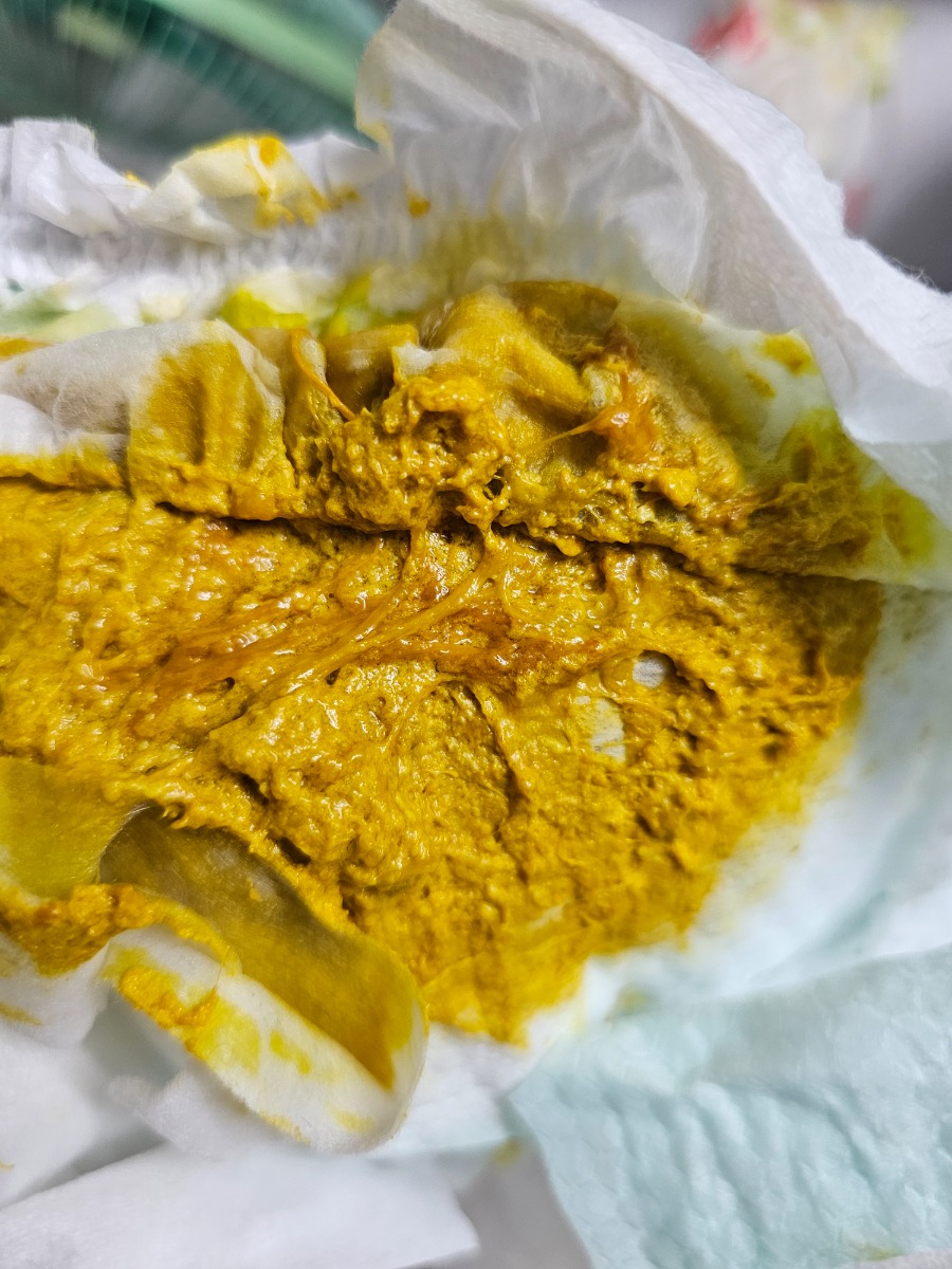 Nay con tôi được 12 ngày tuổi đi phân có màu vàng có thêm chút màu nâu như hình..tôi có nên cho con đi khám không?