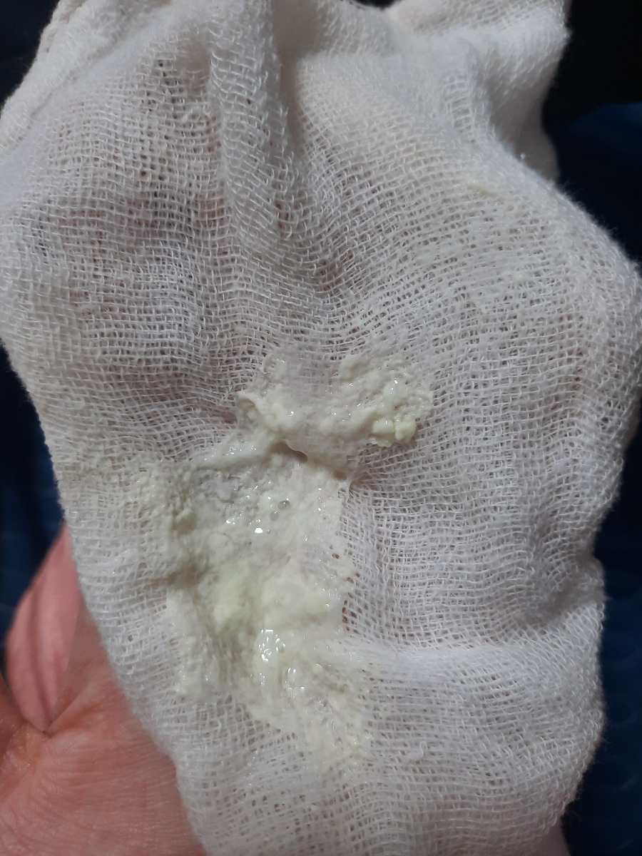 Lúc vỗ ợ hơi bé trớ ra cặn như thế này có bị làm sao không ạ?