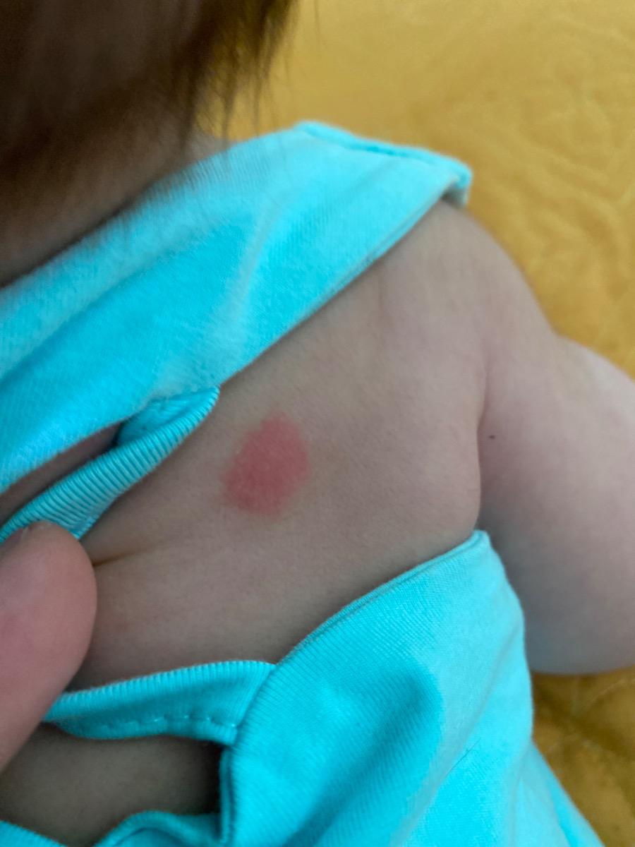 Bé nhà em 2 hôm nay thấy lưng có mấy chấm đỏ này là như nào vậy ạ? Nhờ mn tư vấn giúp em ạ