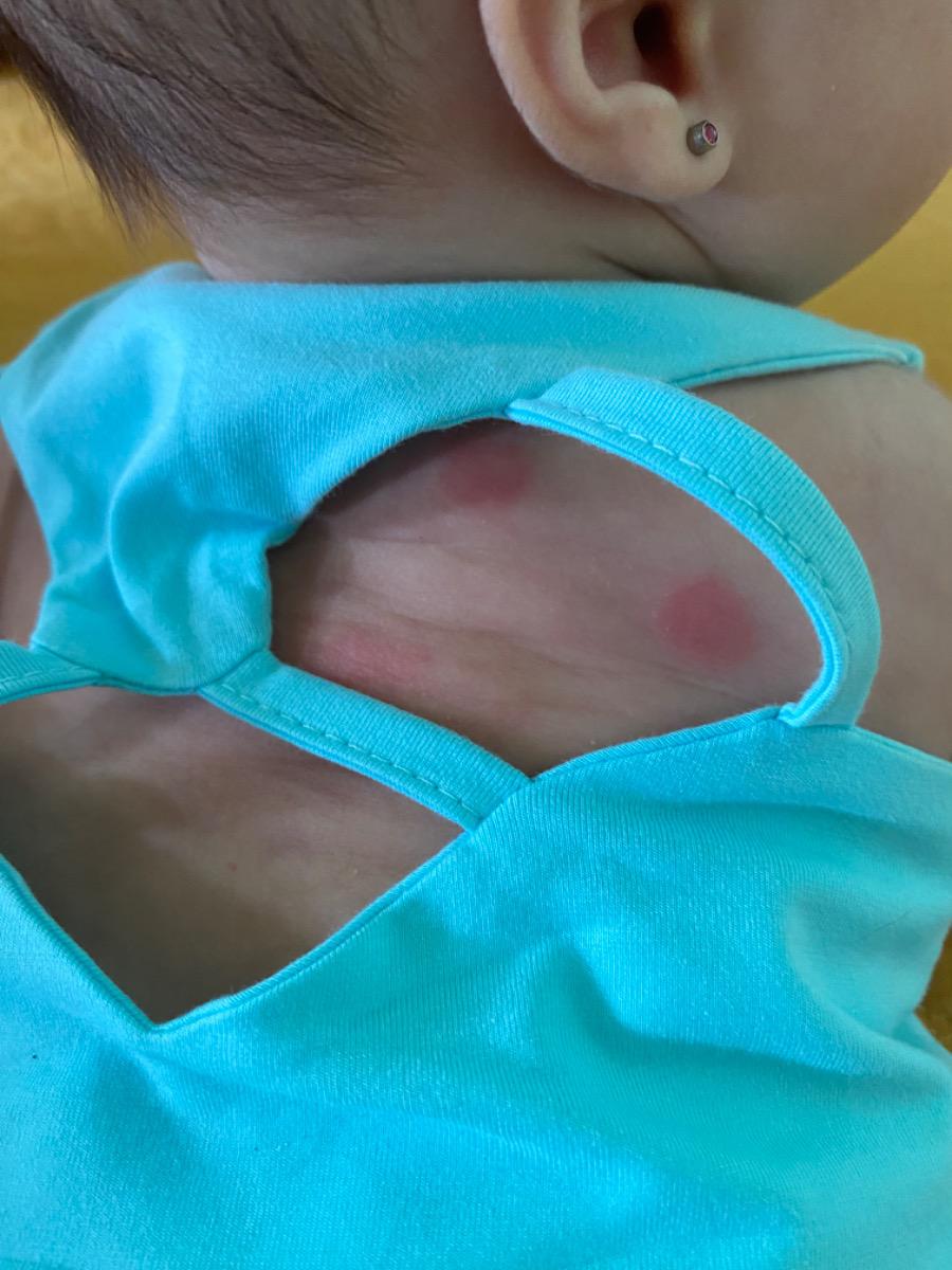 Bé nhà em 2 hôm nay thấy lưng có mấy chấm đỏ này là như nào vậy ạ? Nhờ mn tư vấn giúp em ạ