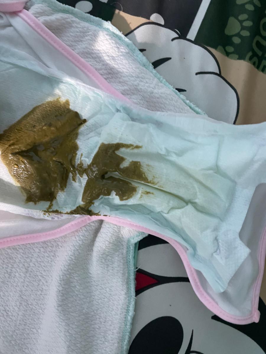 Cho e hỏi bé đi phân như thế này là có bị sao k ạ, dạo này bé nhà e hơi biếng ăn, bé uống sữa công thức chủ yếu ạ